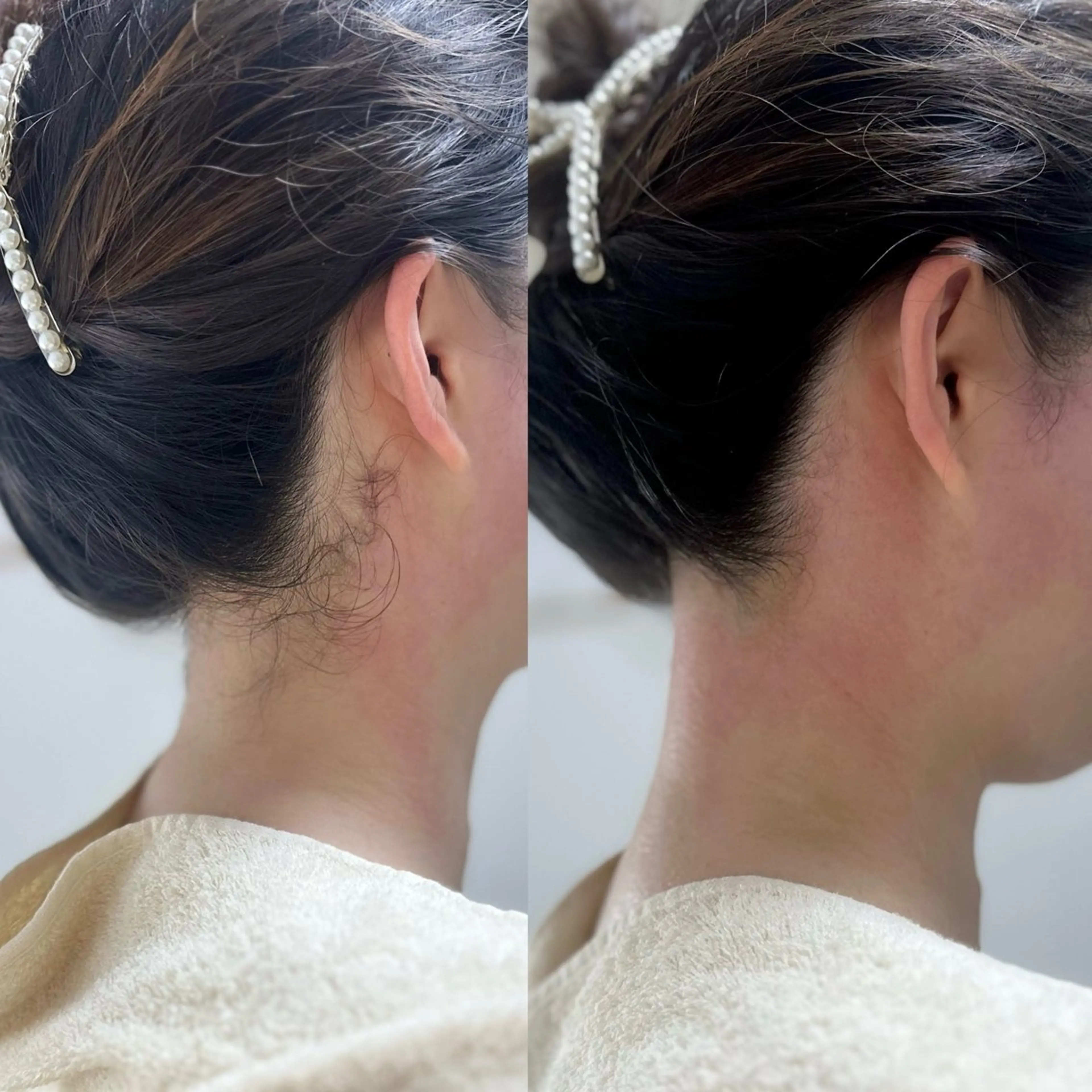 【うなじ＆もみあげWax】髪の毛を結ぶ方から大人気♪後ろ姿美人へ♪の写真