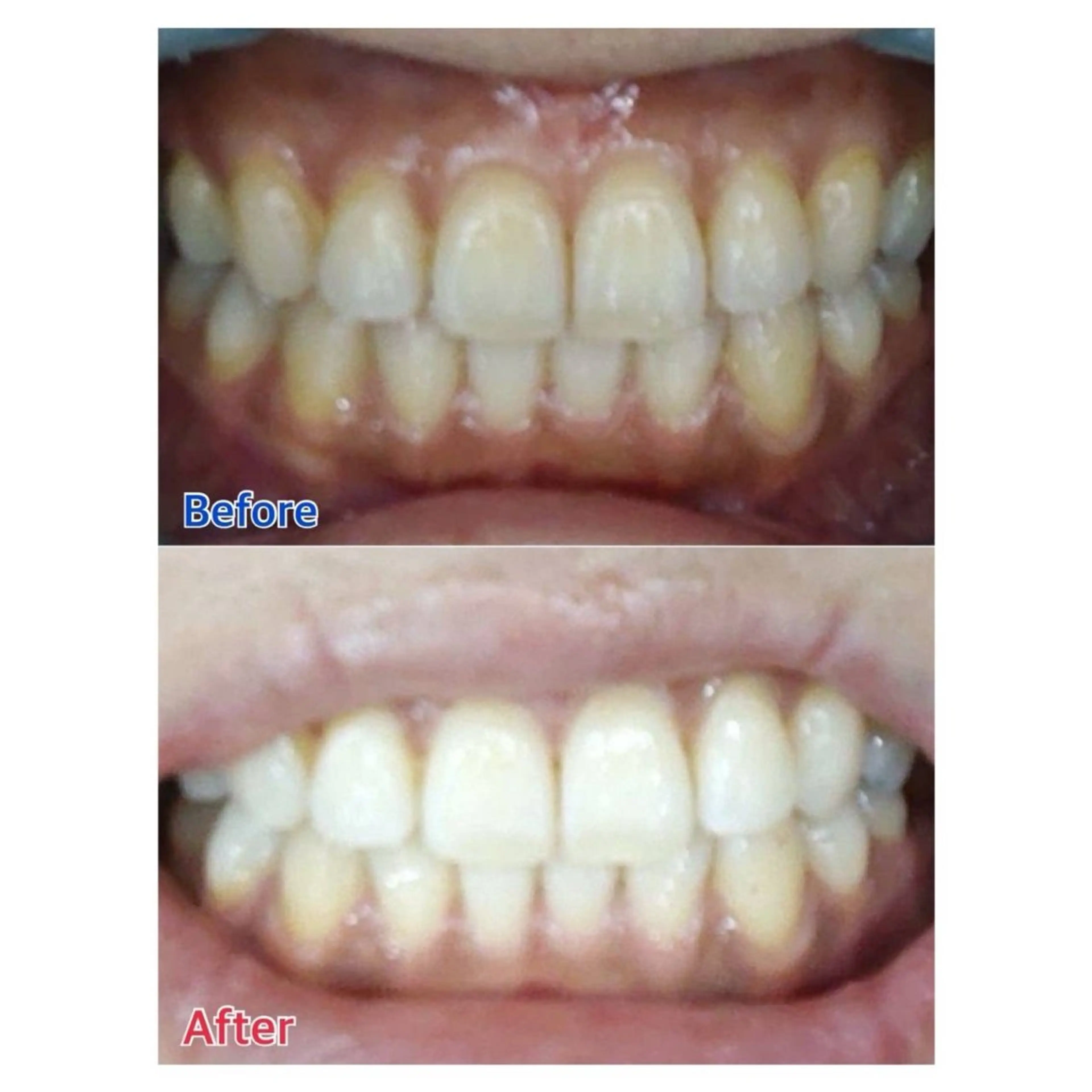 MBEAUTYSALON 千葉店・京成大久保所属・Melty 輝のその他イメージ