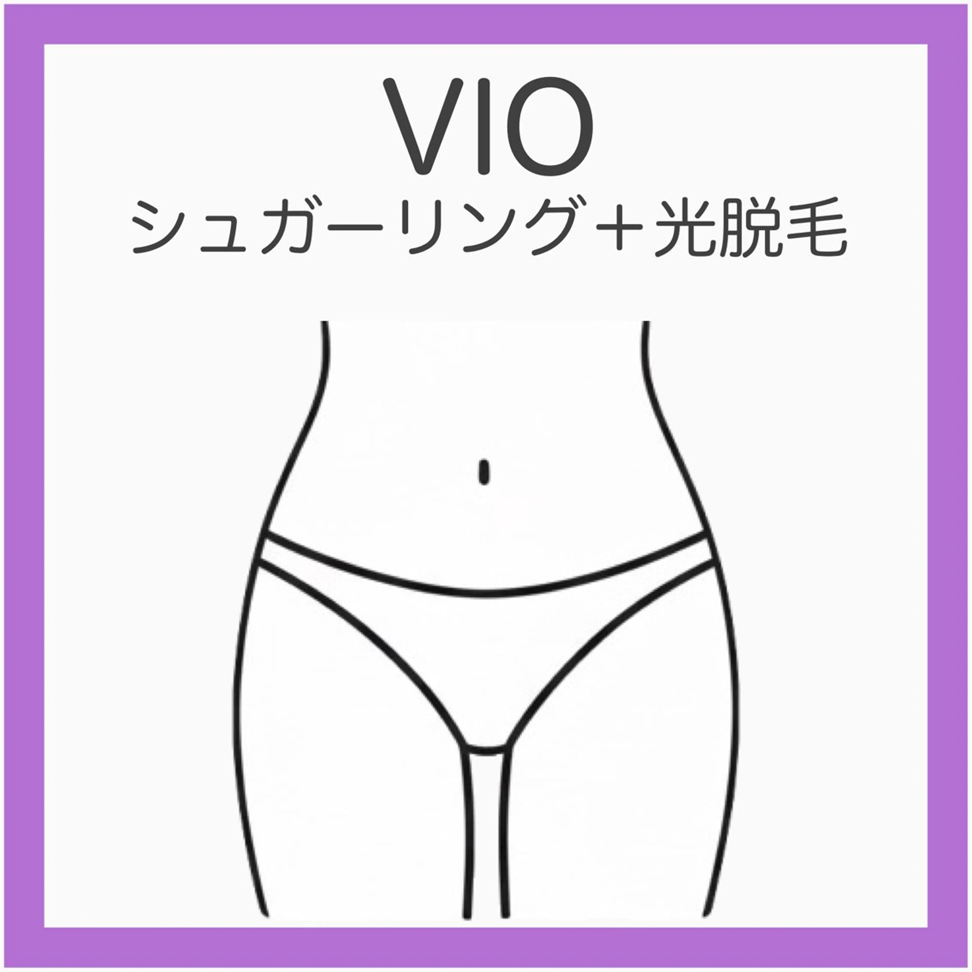 💟VIOシュガーリング＋光脱毛《しぶといVIOに最適》即日ツルツルで仕上がり満足！キレイ長持ちはこれ！の写真