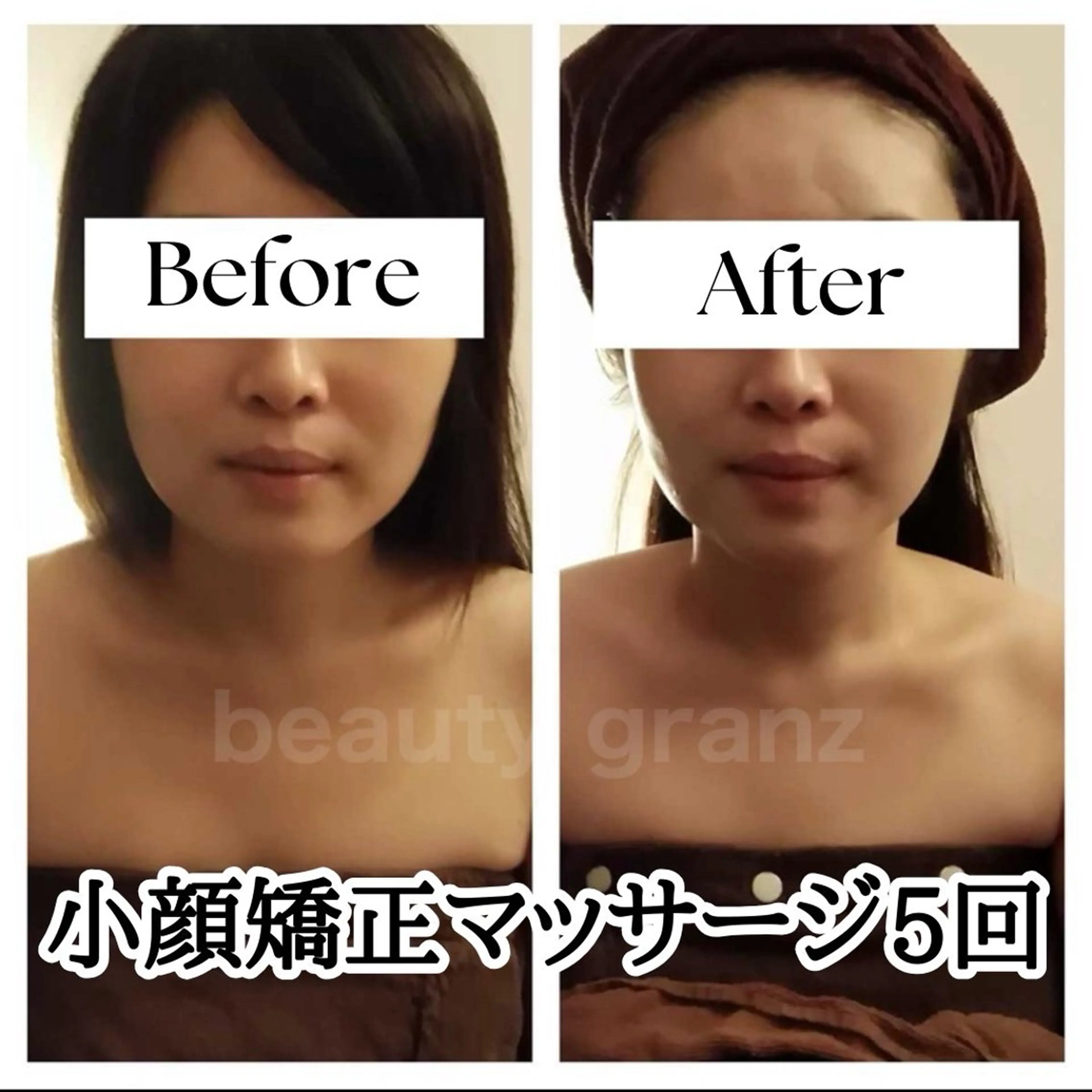 エステ 毛穴ニキビ専門 ビューティーグランツのエステ・リラクイメージ