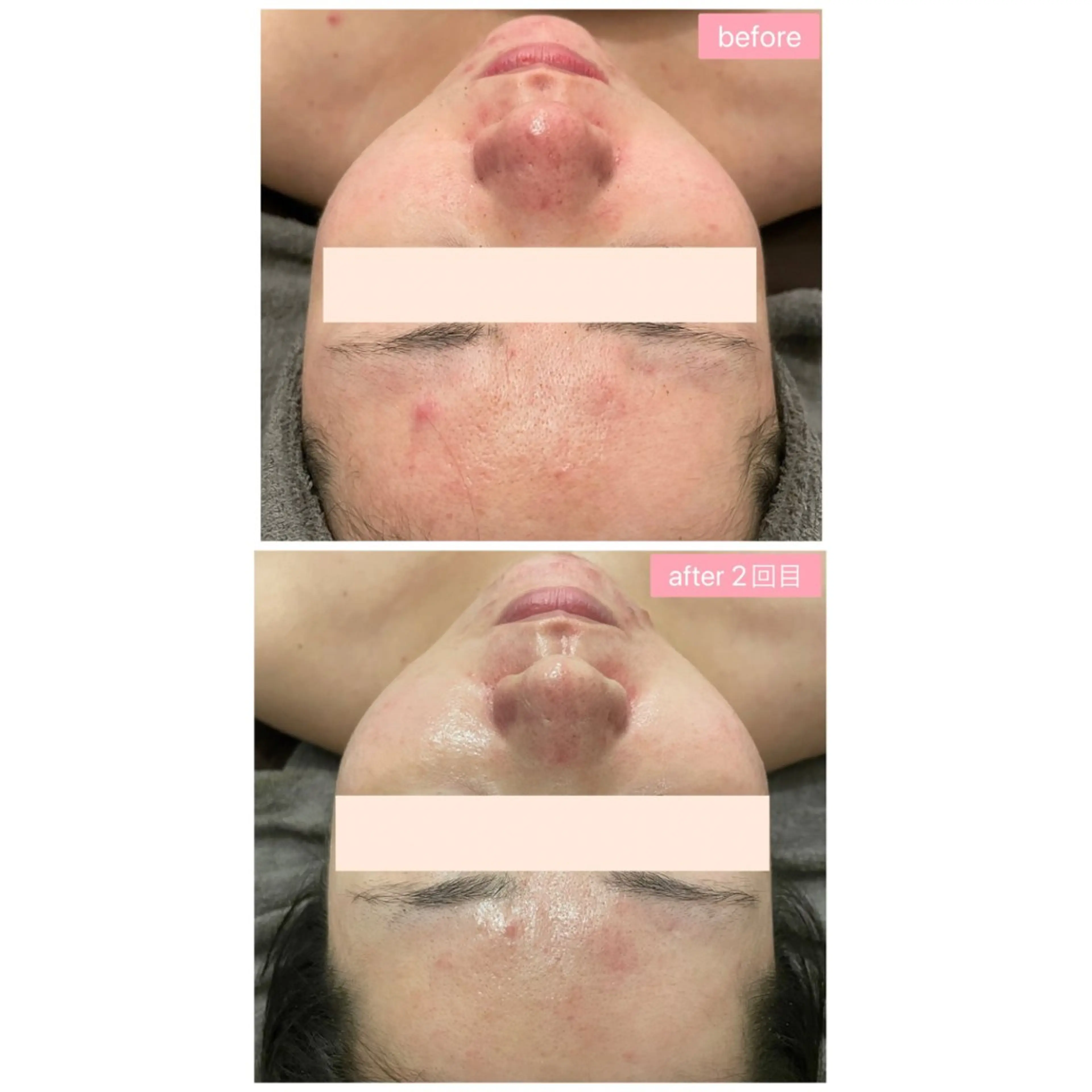 Monart -deux-のエステ・リラクイメージ