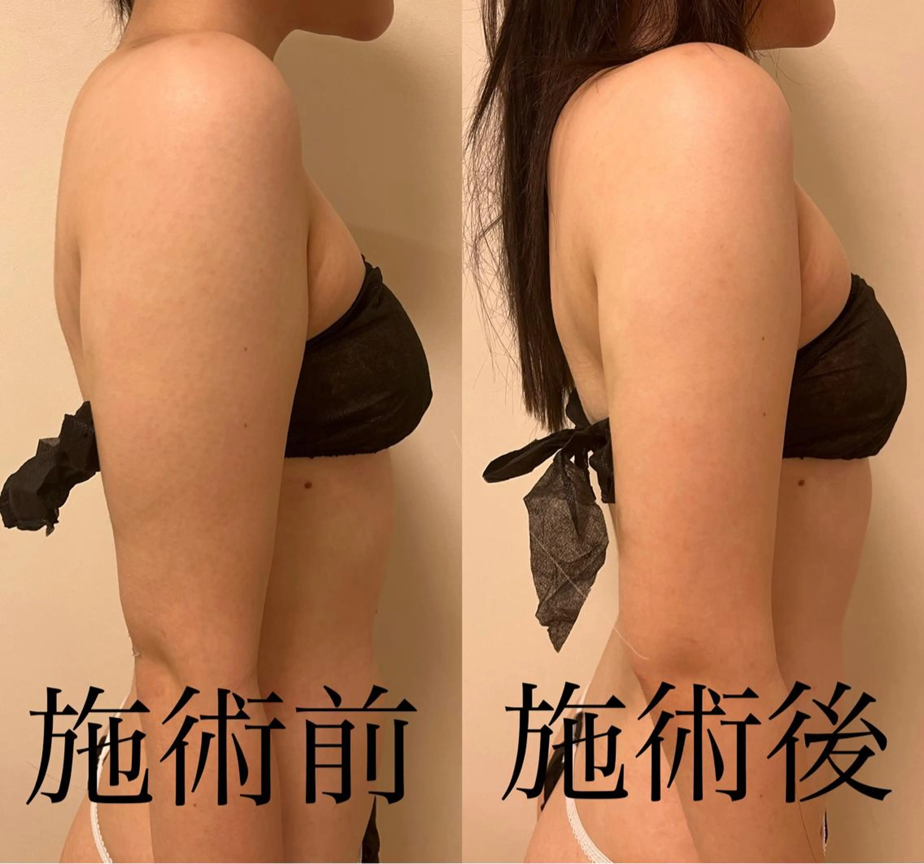 WOM SALON所属・MIKU【美容整形ダ ウンタイムケア銀座】のエステ・リラクイメージ