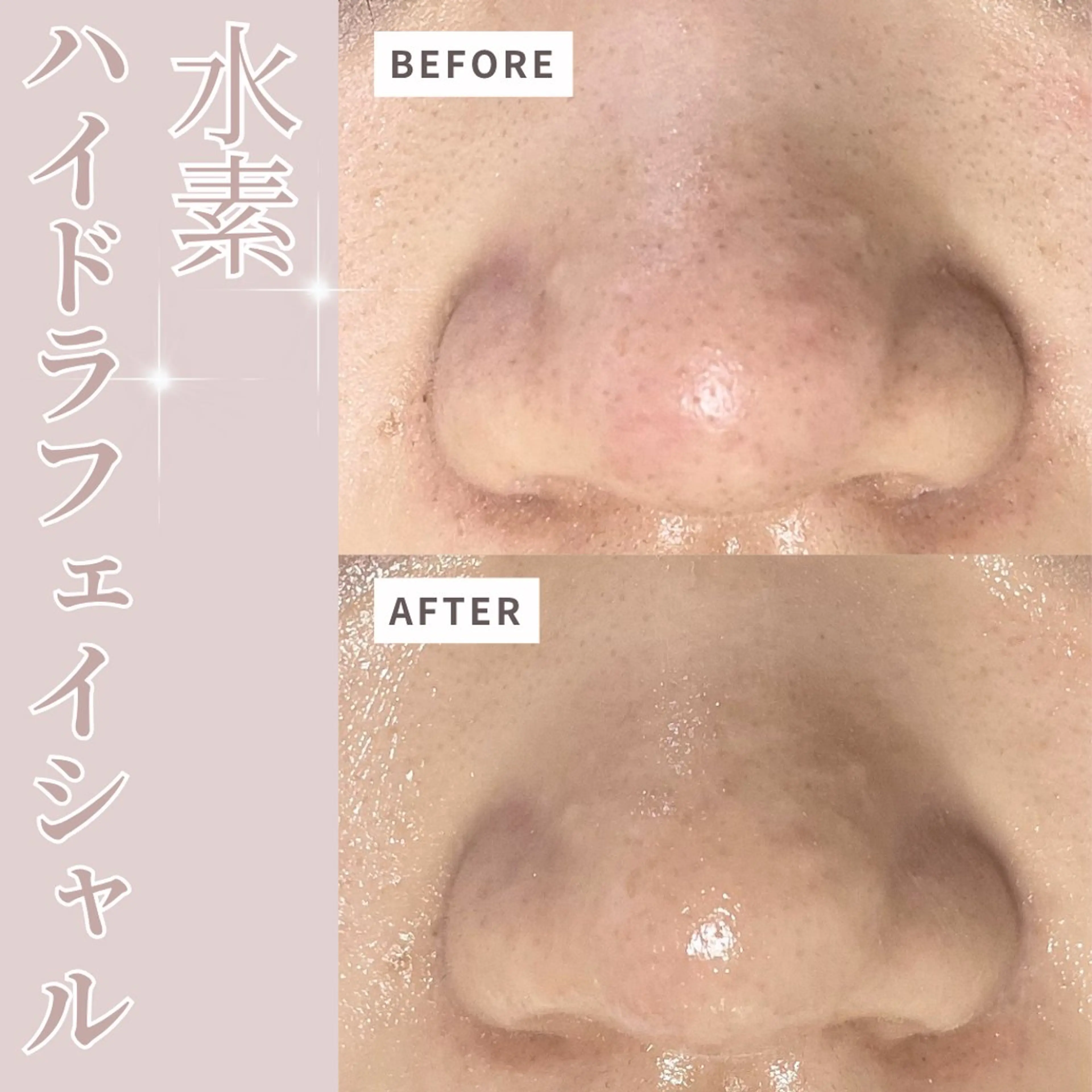 その他 プライベートサロン Belle（ベル）のエステ・リラクイメージ