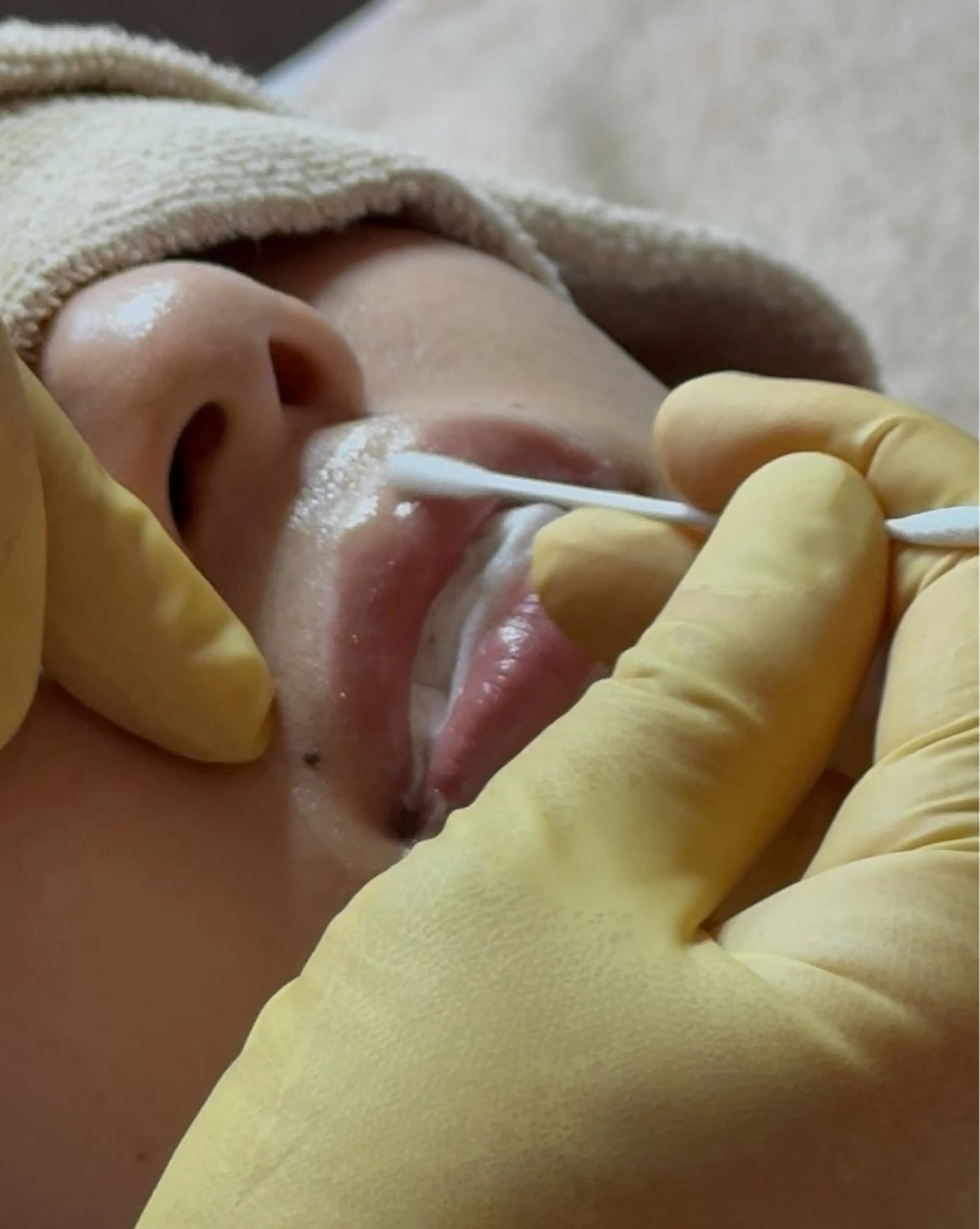 【話題のメラニンケア】ローマピンク/リップ🎀写真モニター150,000円→99,000円🌿アフタークリーム3本付き♪の写真