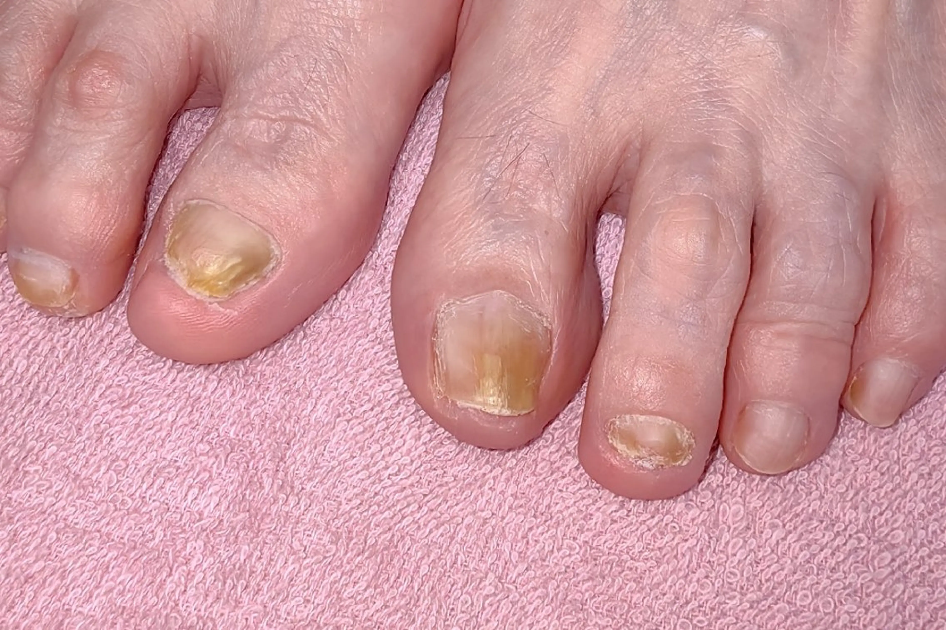 ネイル フットネイル reve あやののネイルデザイン