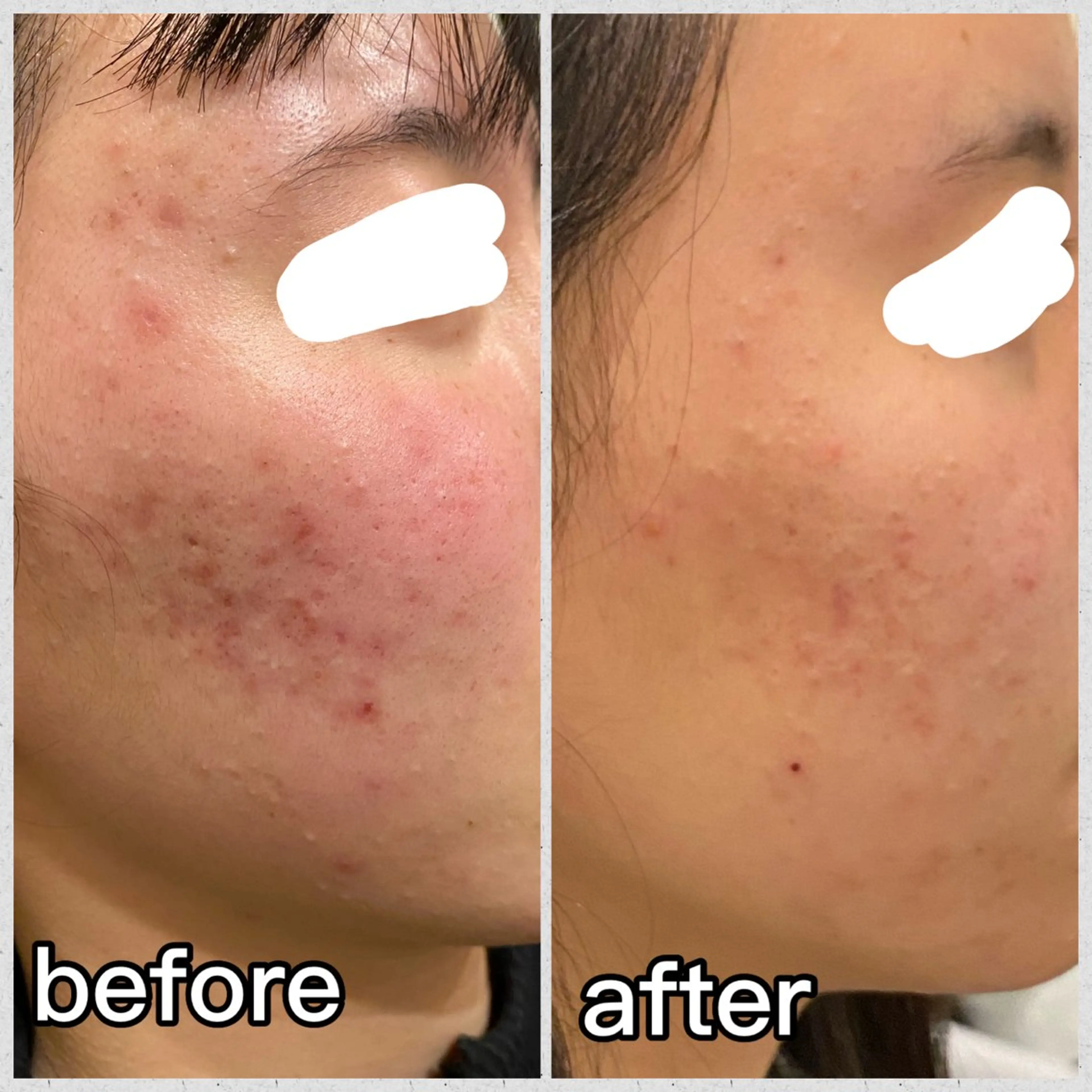 aimer beautyのエステ・リラクイメージ