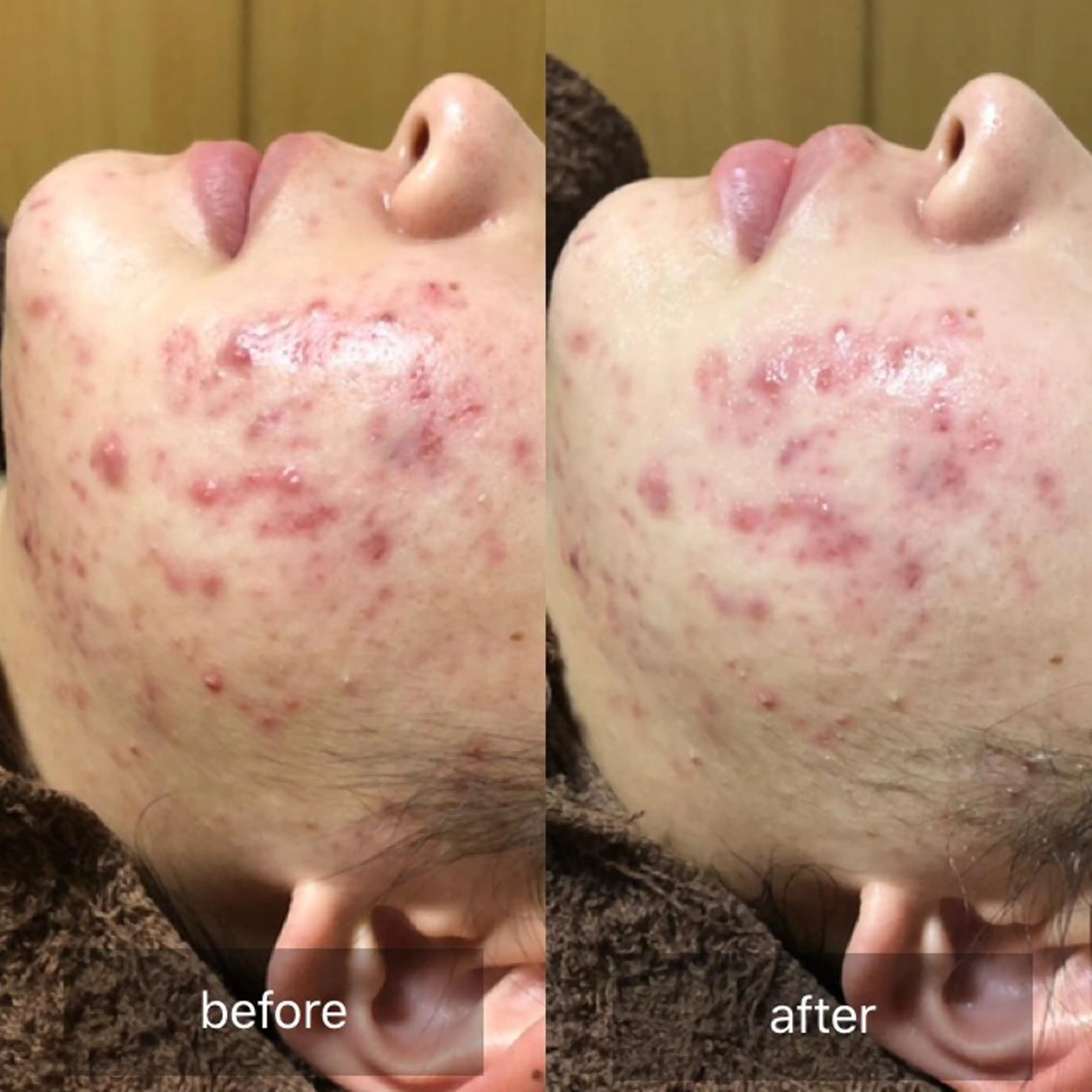 未病ケアサロン　EMINY所属・未病ケアサロン EMINY☺︎勝俣のエステ・リラクイメージ