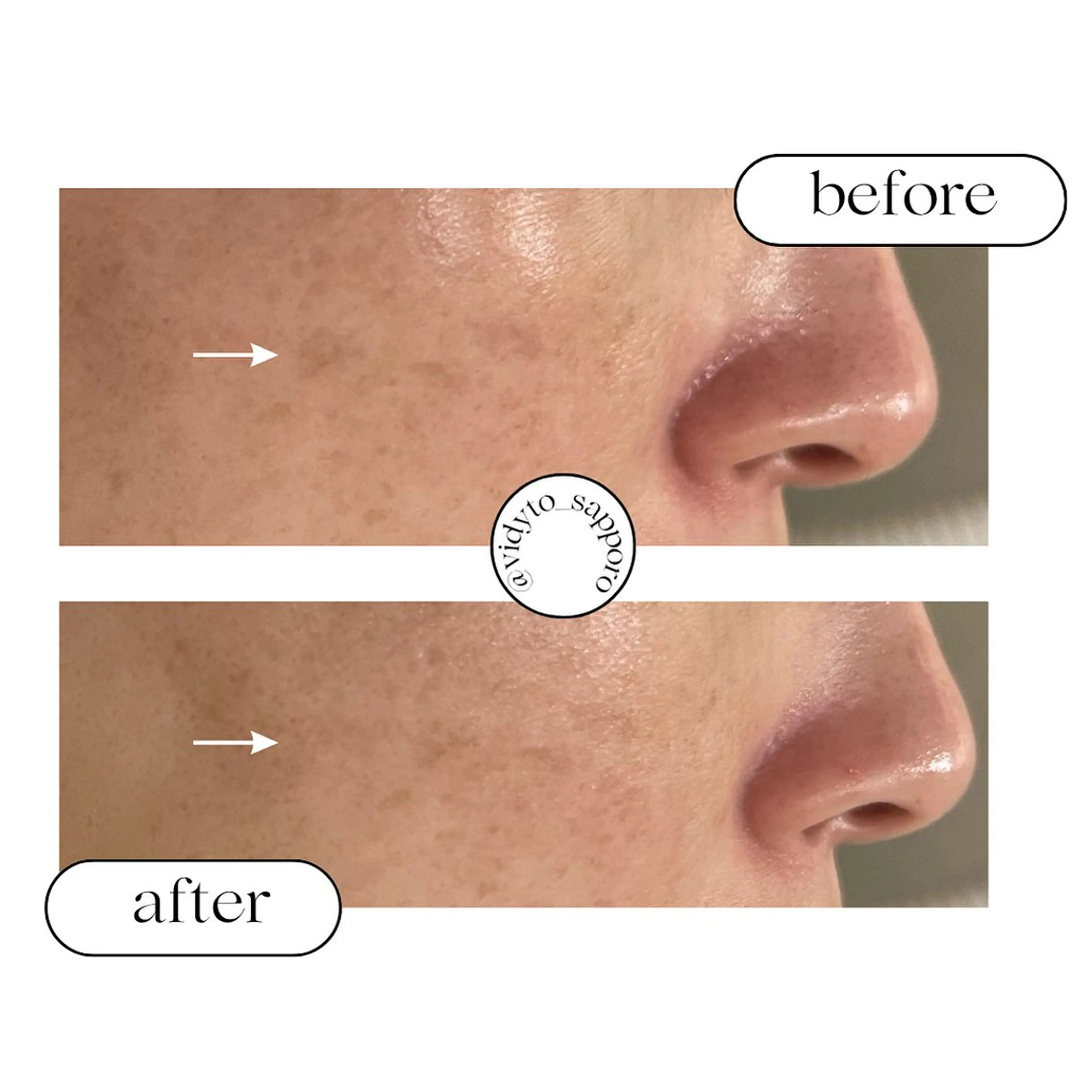 エステ リラク 【vidyto】ヴィディトゥ所属・肌管理サロン vidyto　MOEのエステ・リラクイメージ