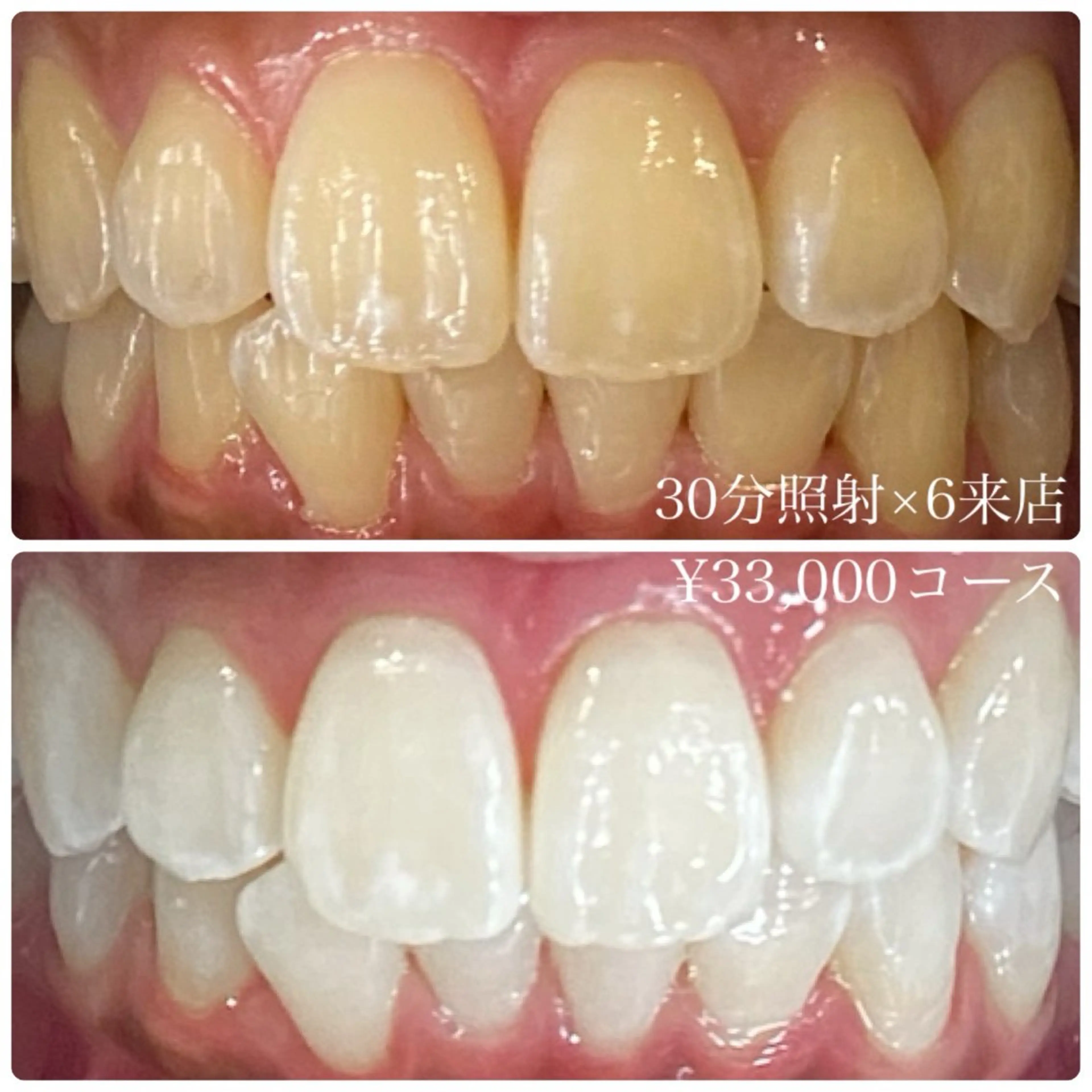 PLATINUM Beauty 横浜店所属・ホワイトニングルーム 横浜店のその他イメージ