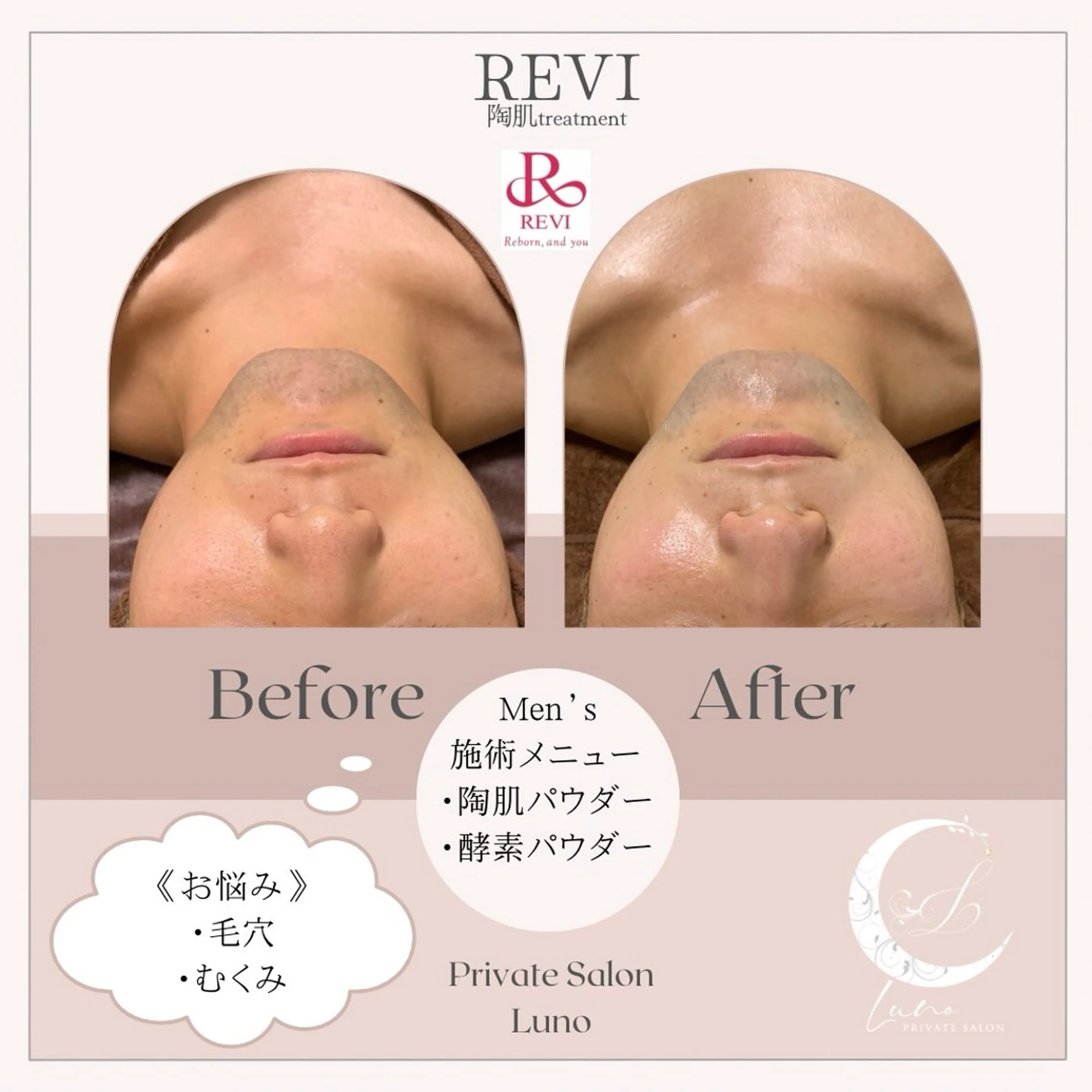 エステ Luno REVI導入サロンのエステ・リラクイメージ