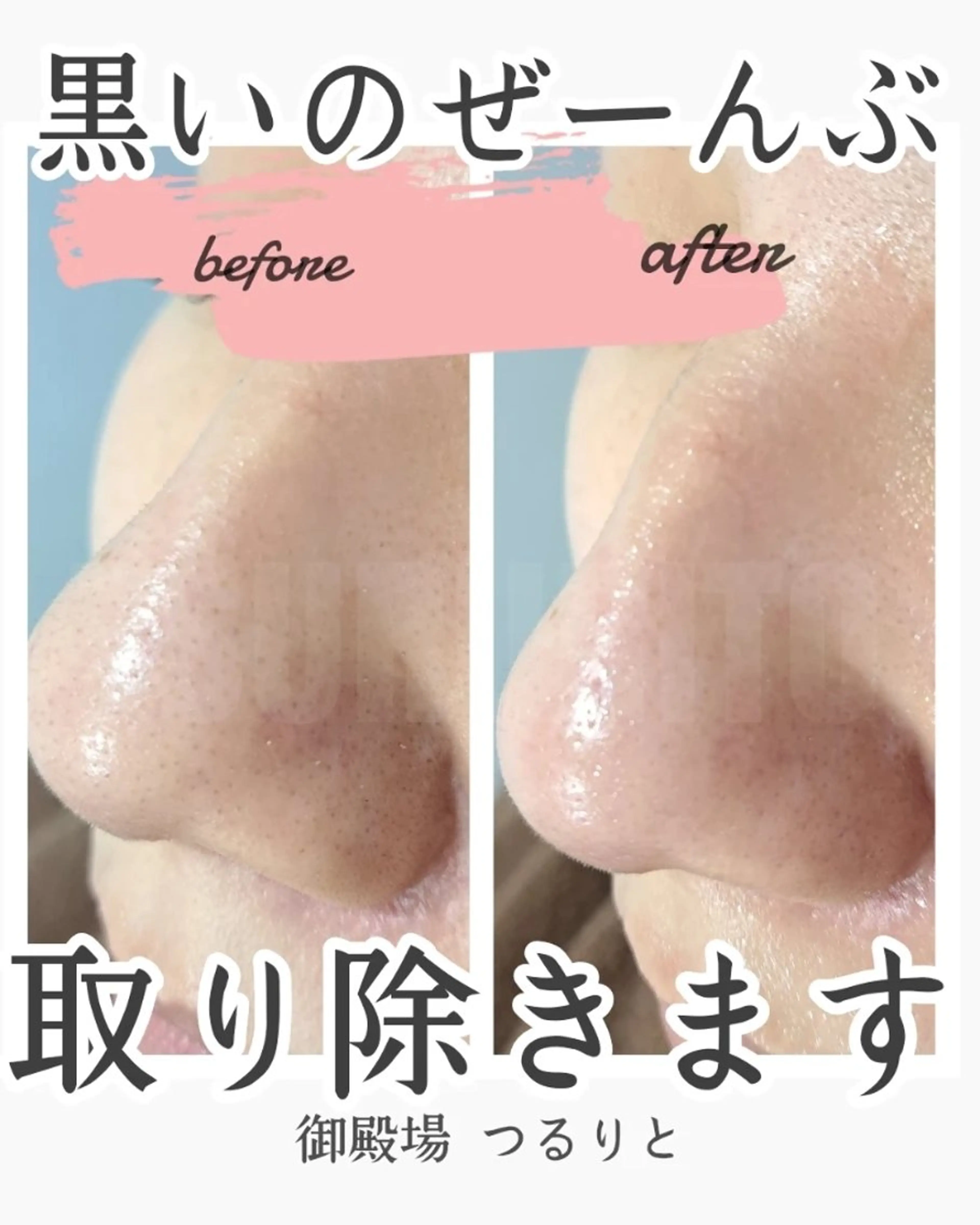 美肌脱毛サロン つるりと御殿場店所属・美肌脱毛サロン つるりとのその他イメージ