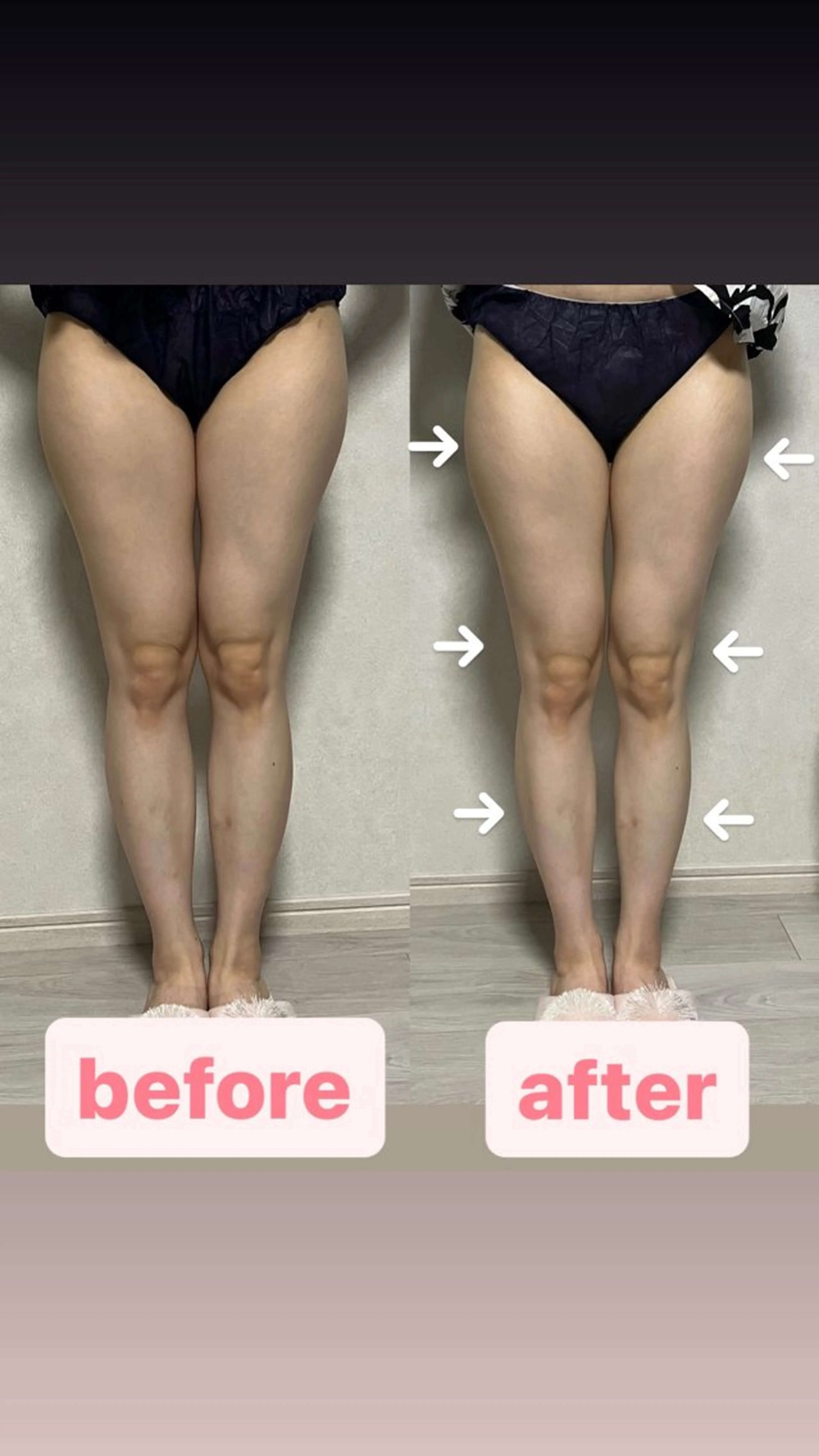 salon de blue rose所属・ハイパーナイフ専門 熊田陽子のエステ・リラクイメージ