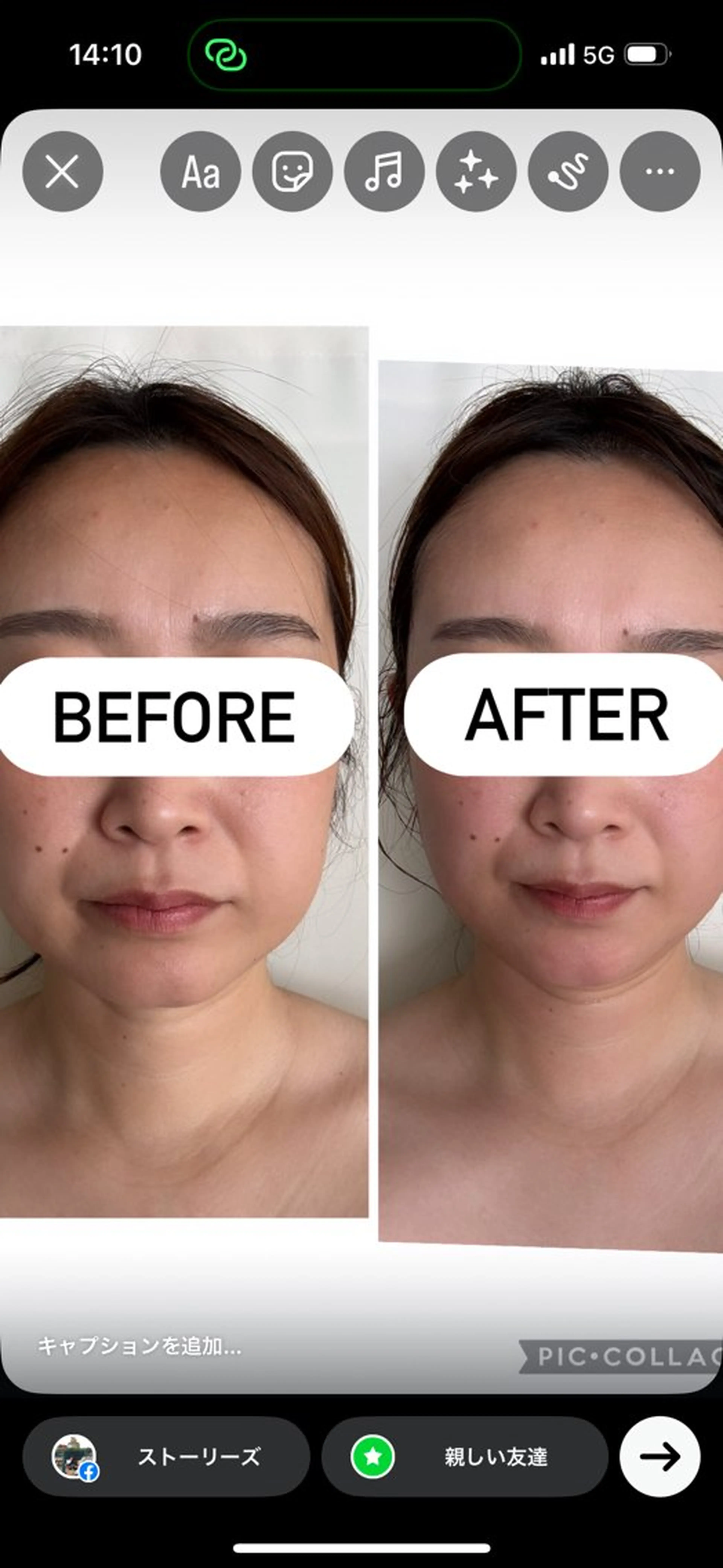 エステ 【三軒茶屋/下馬】 本格痩身・よもぎ蒸しのエステ・リラクイメージ