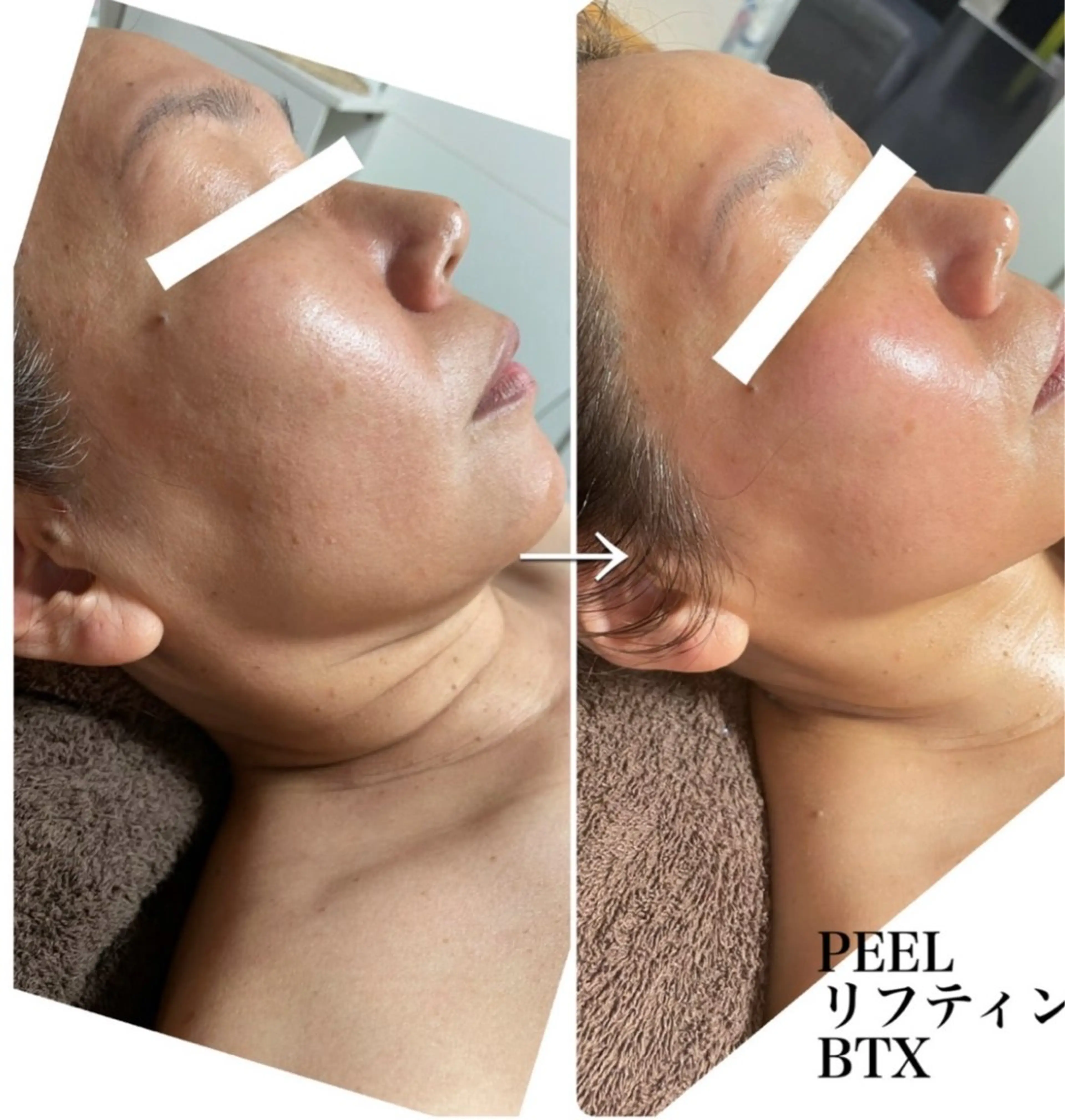 Total Beauty salon Bloom所属・肌育WISHpro 専門サロンBloomのエステ・リラクイメージ