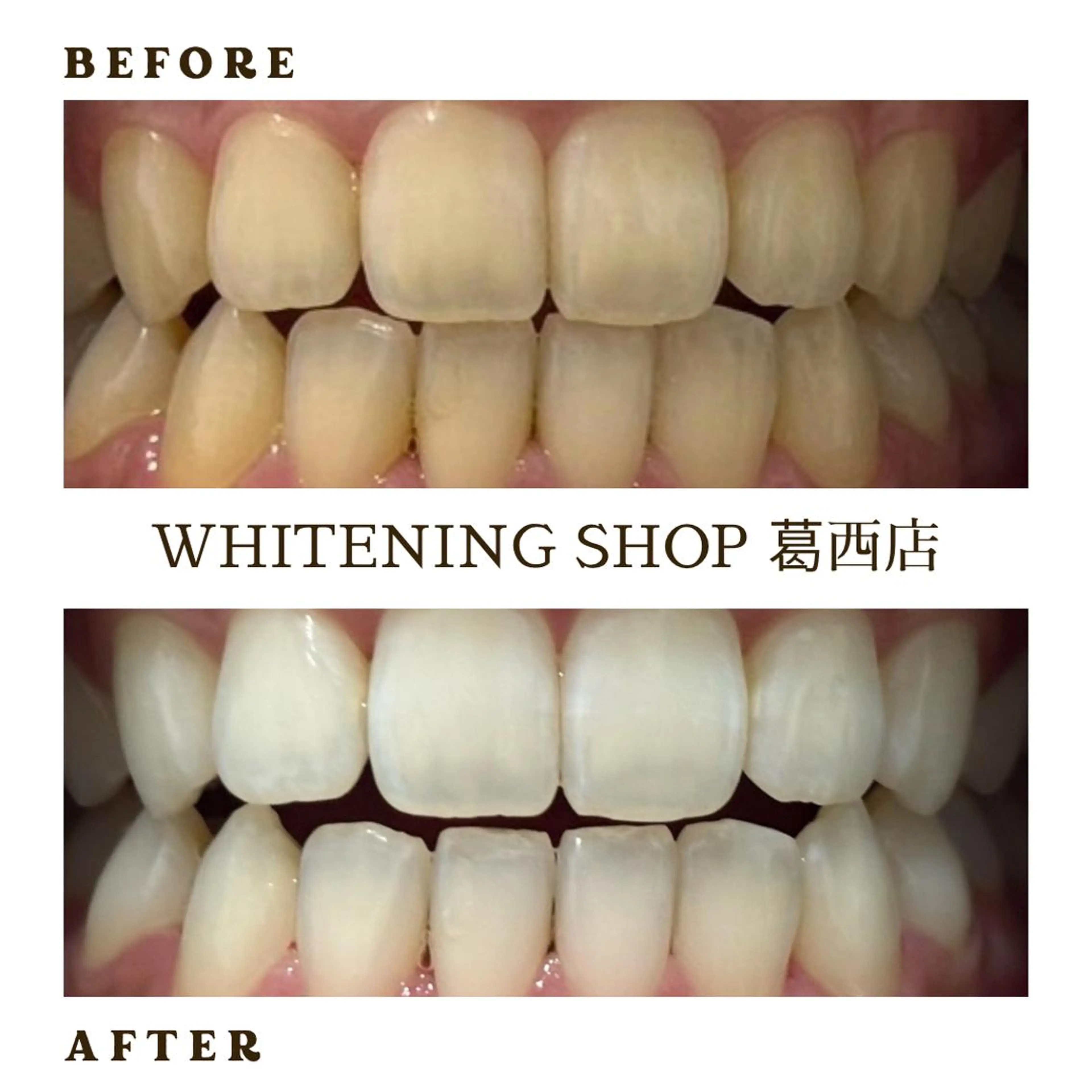 メンズ その他 ホワイトニング ショップ葛西店のその他イメージ