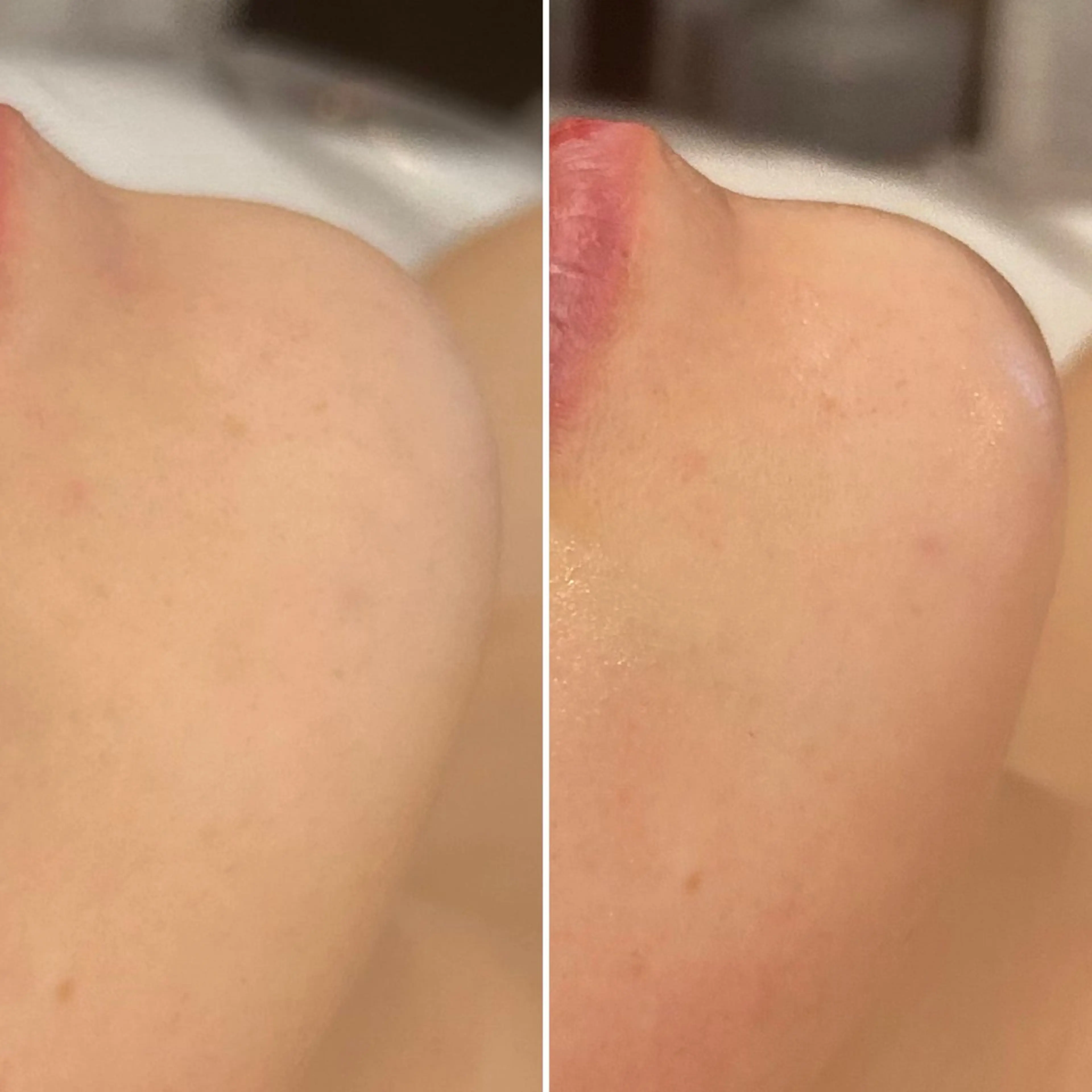 エステ 韓国🇰🇷価格 サロン_Nbibiのエステ・リラクイメージ