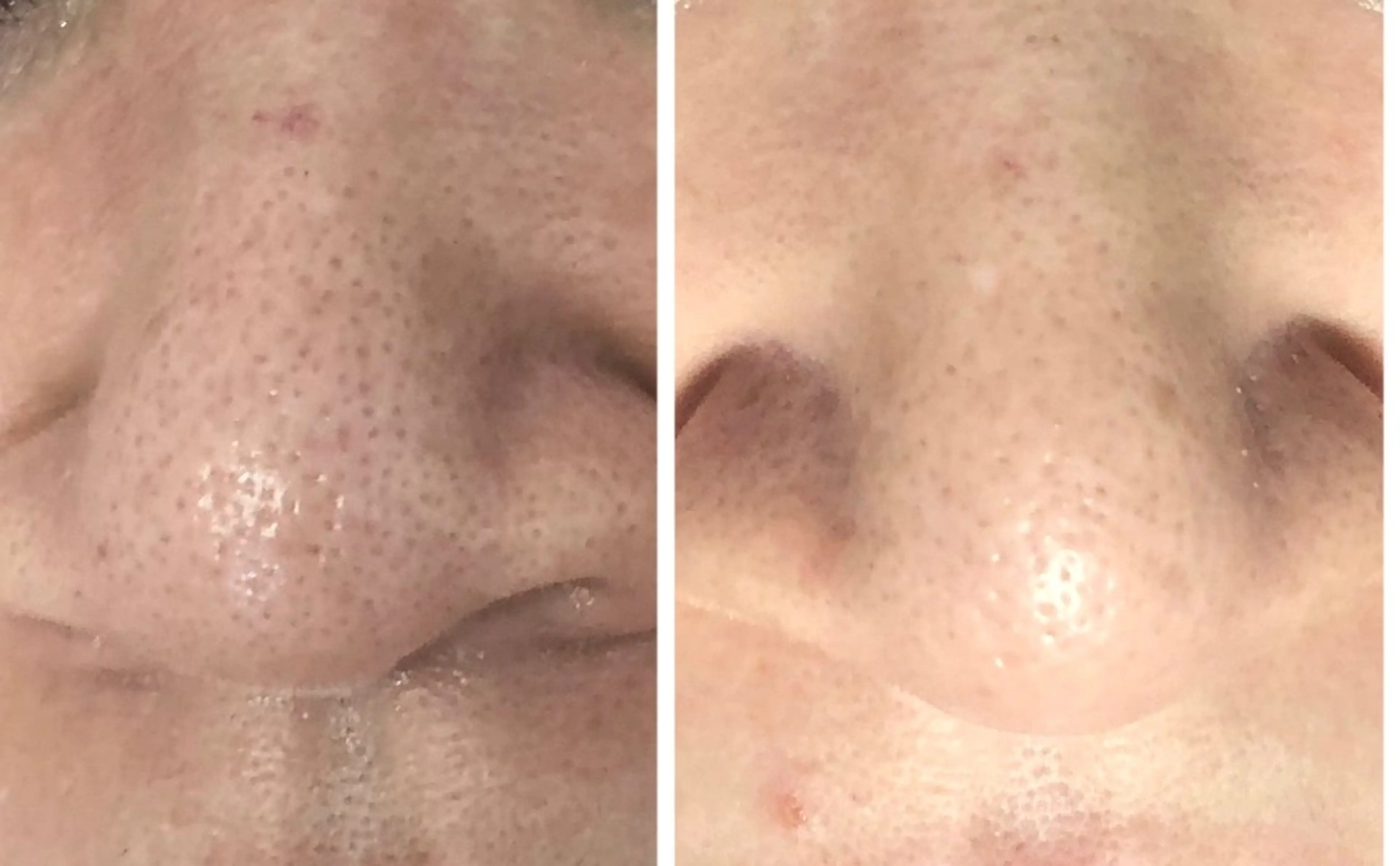 private salon  Dea_maris シュガーリング＆パーソナルボディケア所属・シミ改善・韓国肌管理 ボディメイク痩身のその他イメージ