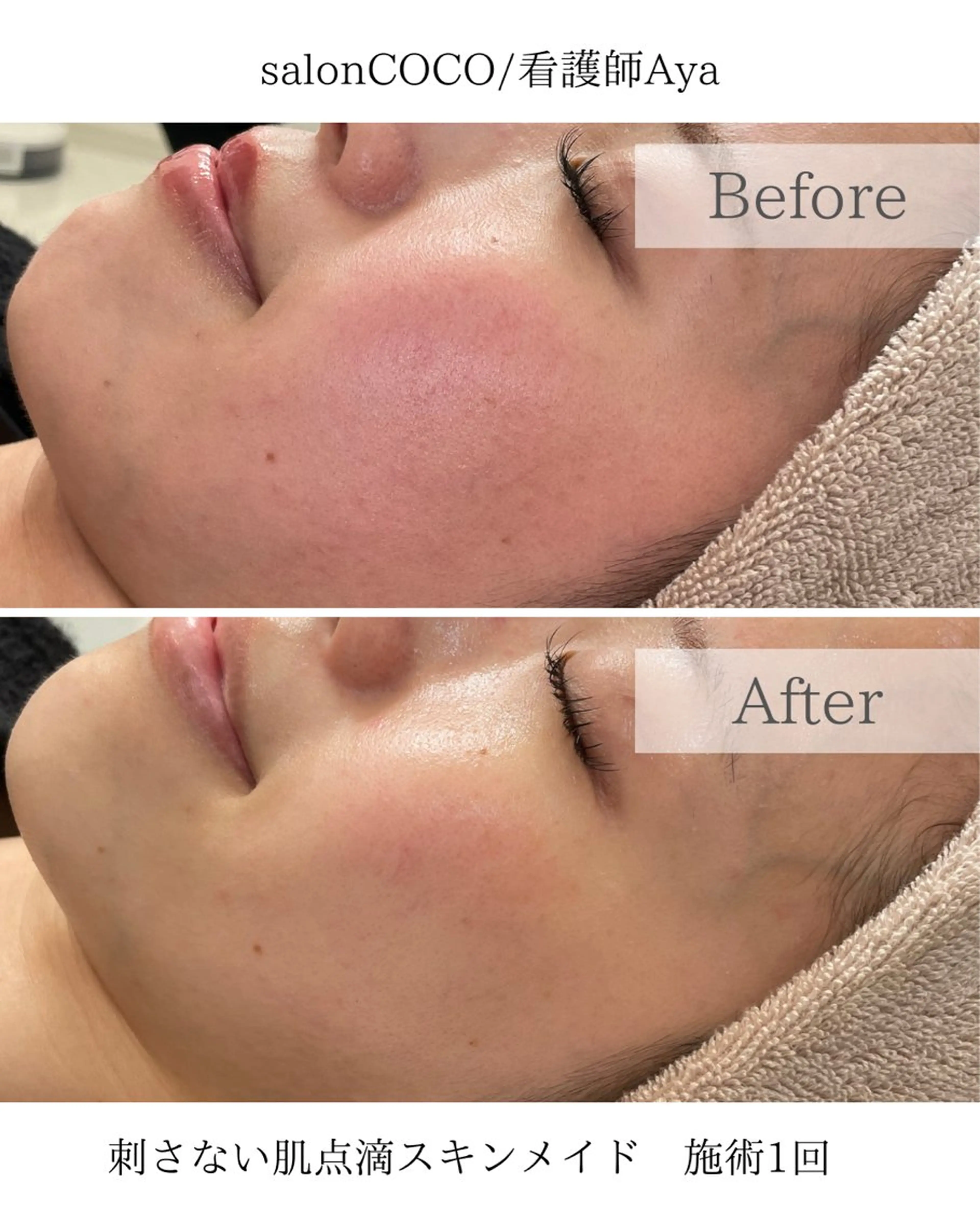 エステ salonCOCO所属・肌管理看護師💎 salonCOCOのエステ・リラクイメージ