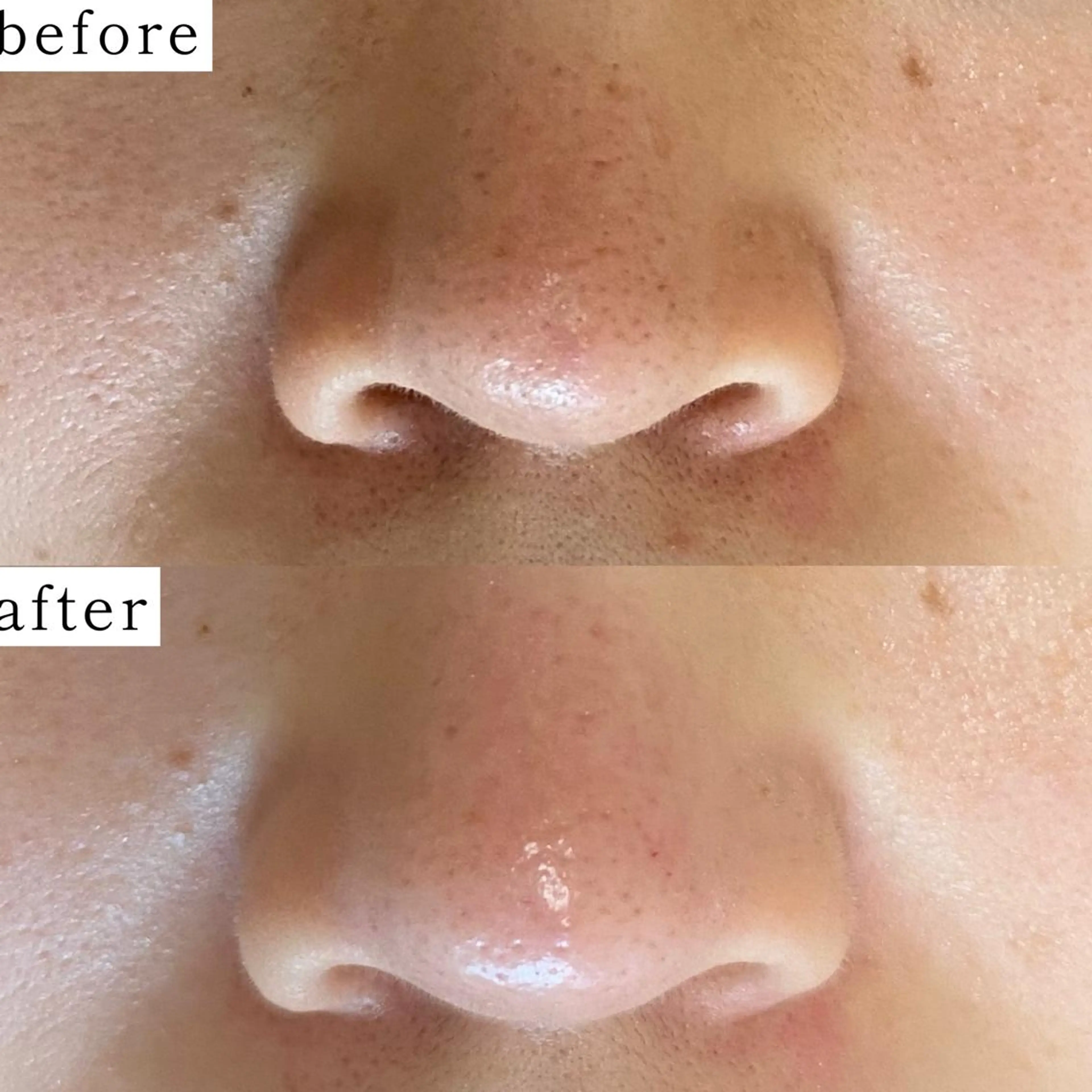 毛穴専門サロン　フルール所属・フルールFululu 自由が丘のエステ・リラクイメージ