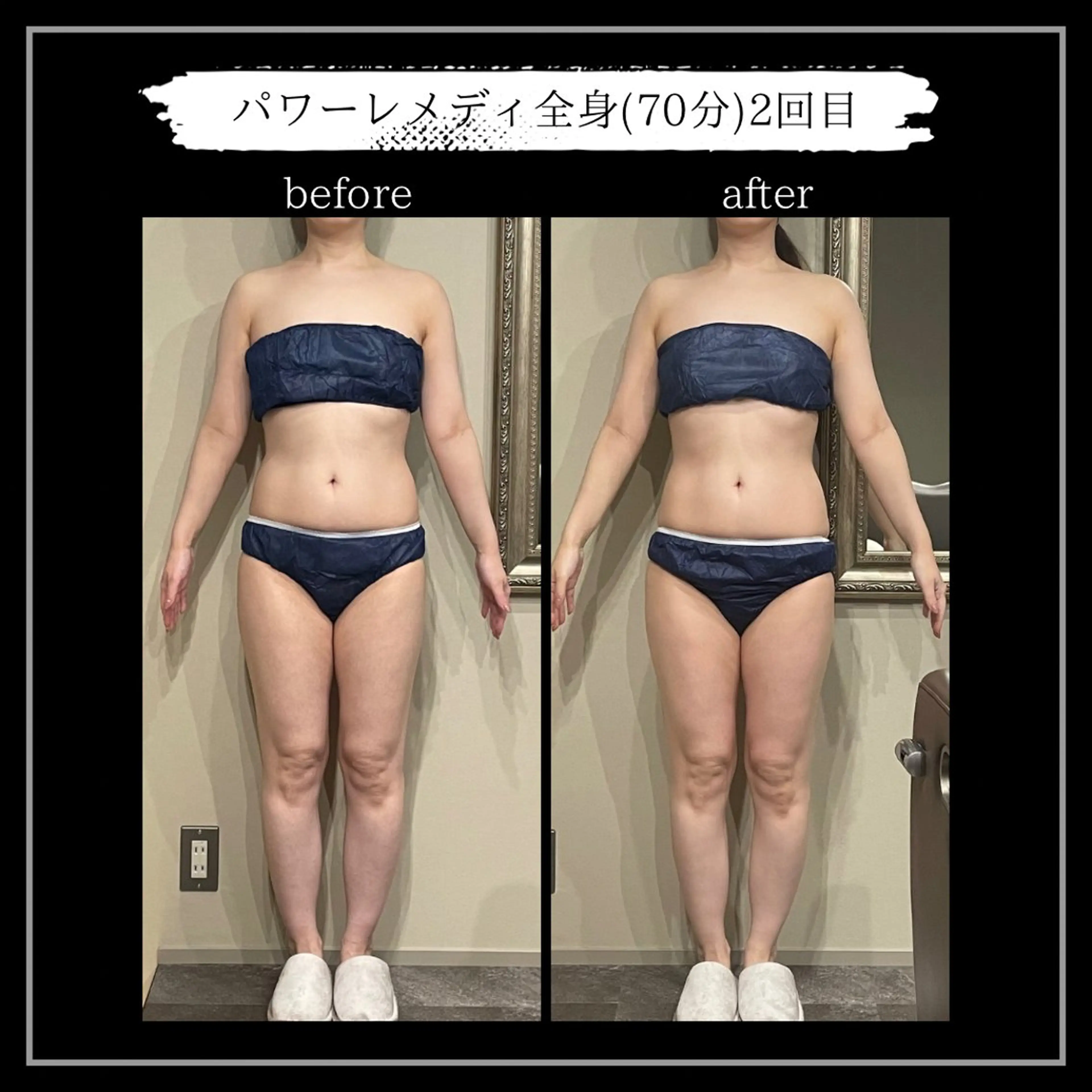 オフ:オン所属・オフ:オン 全身筋膜マッサージのエステ・リラクイメージ