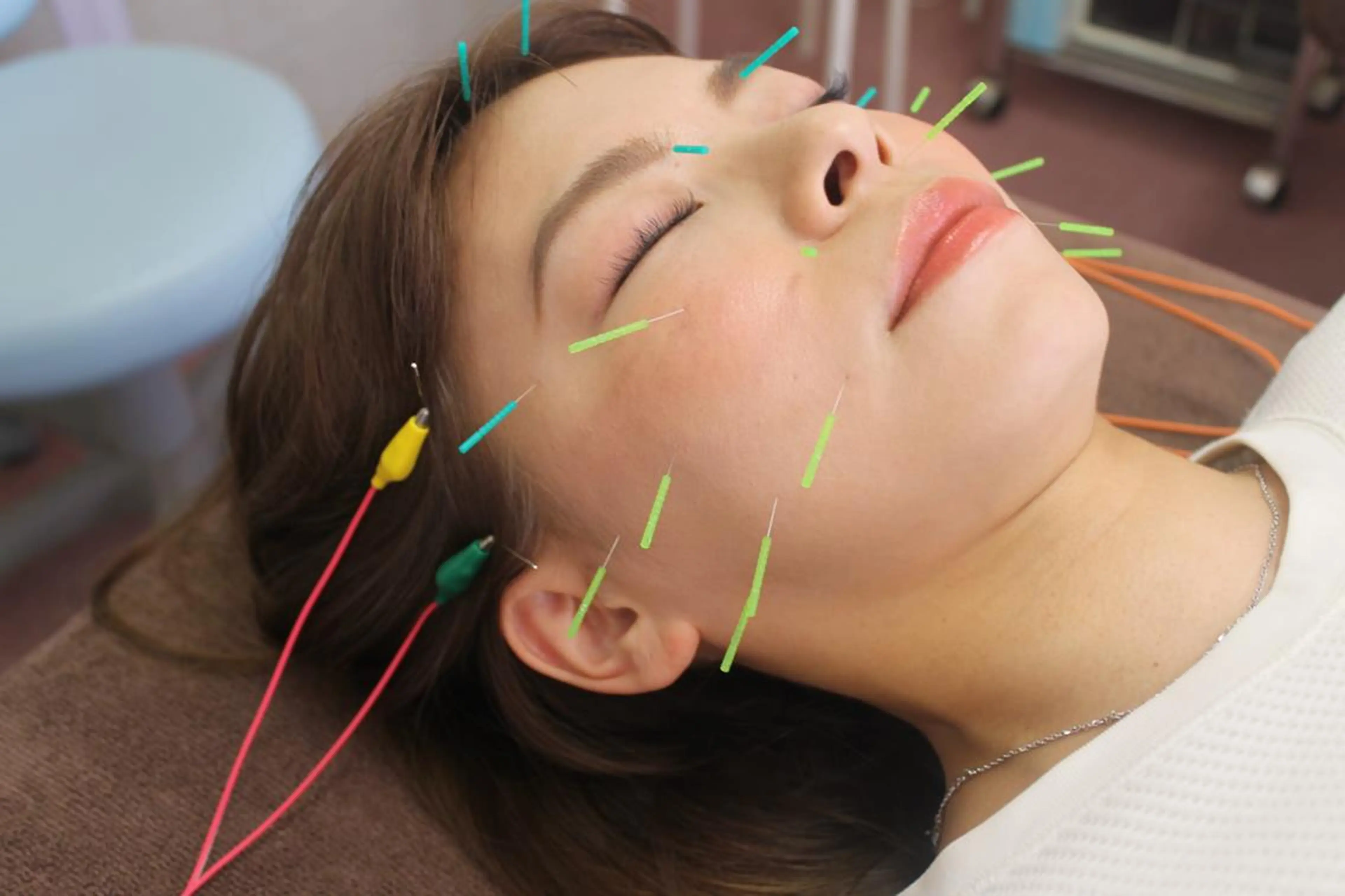 エステ 同心整骨院 美容鍼・整体・小顔のエステ・リラクイメージ