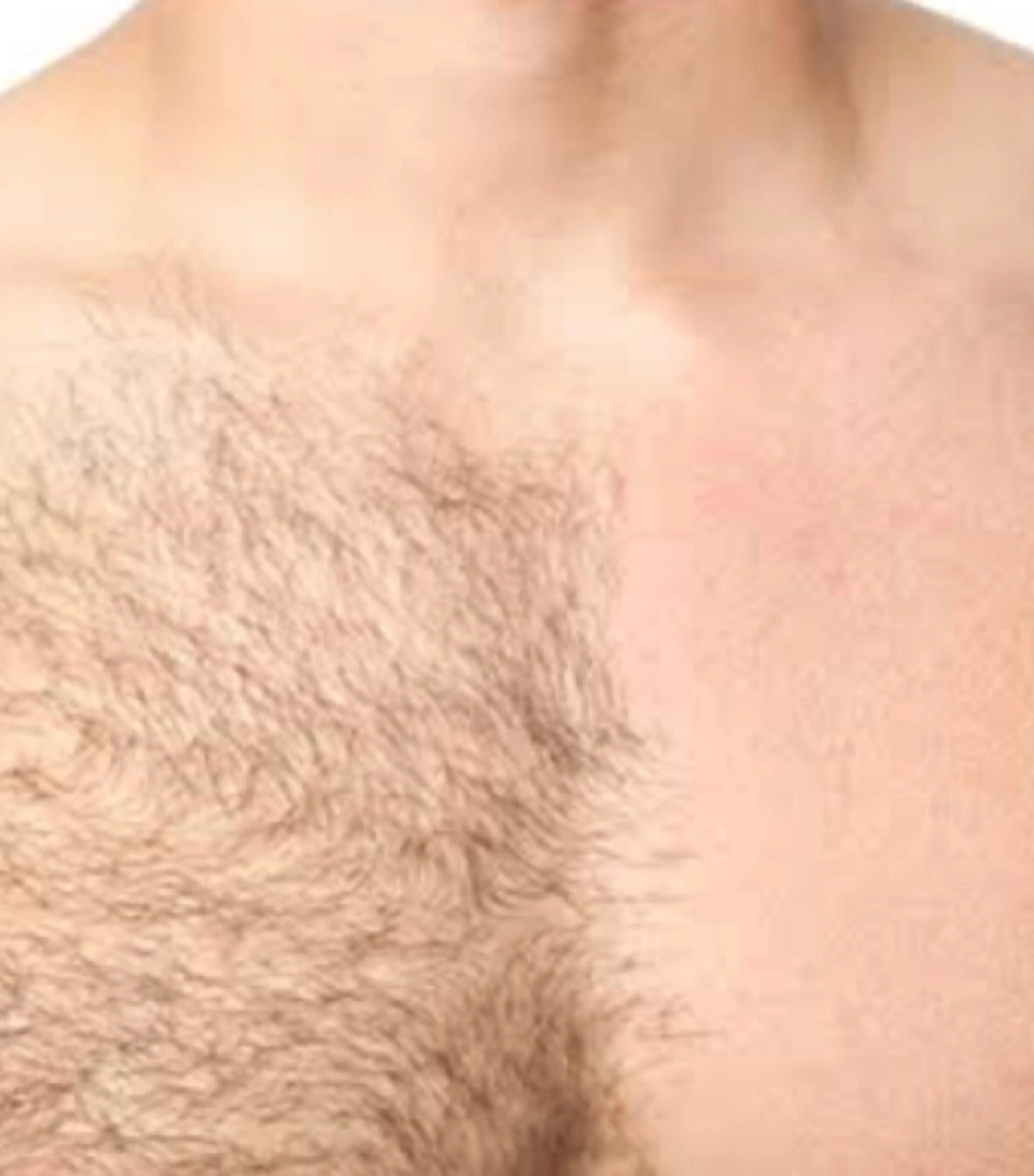 【メンズ】Lパーツ　光もしくはワックス脱毛の写真