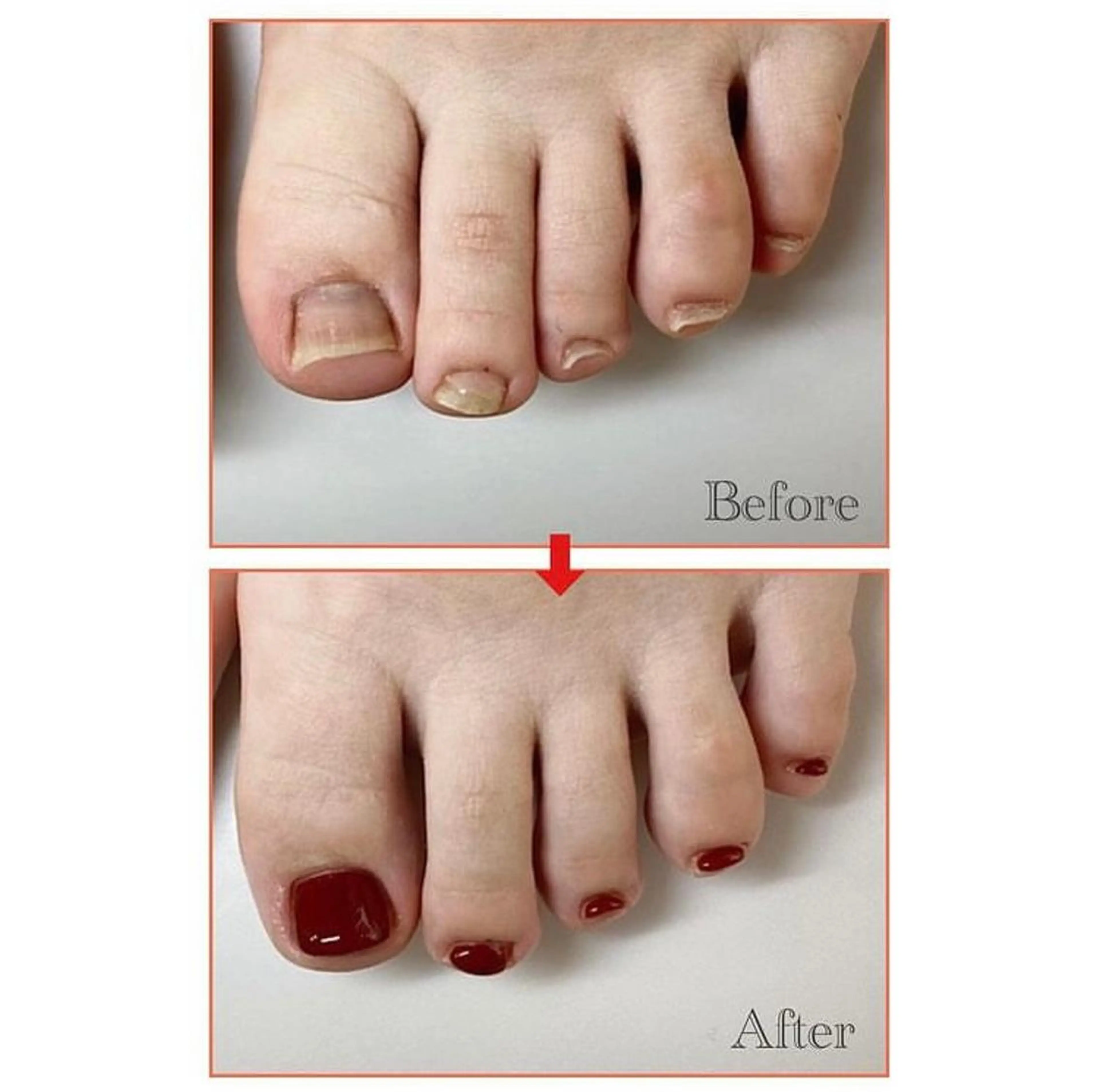 ネイル フットネイル ネイルサロンアリューム所属・ネイルサロン アリュームのネイルデザイン