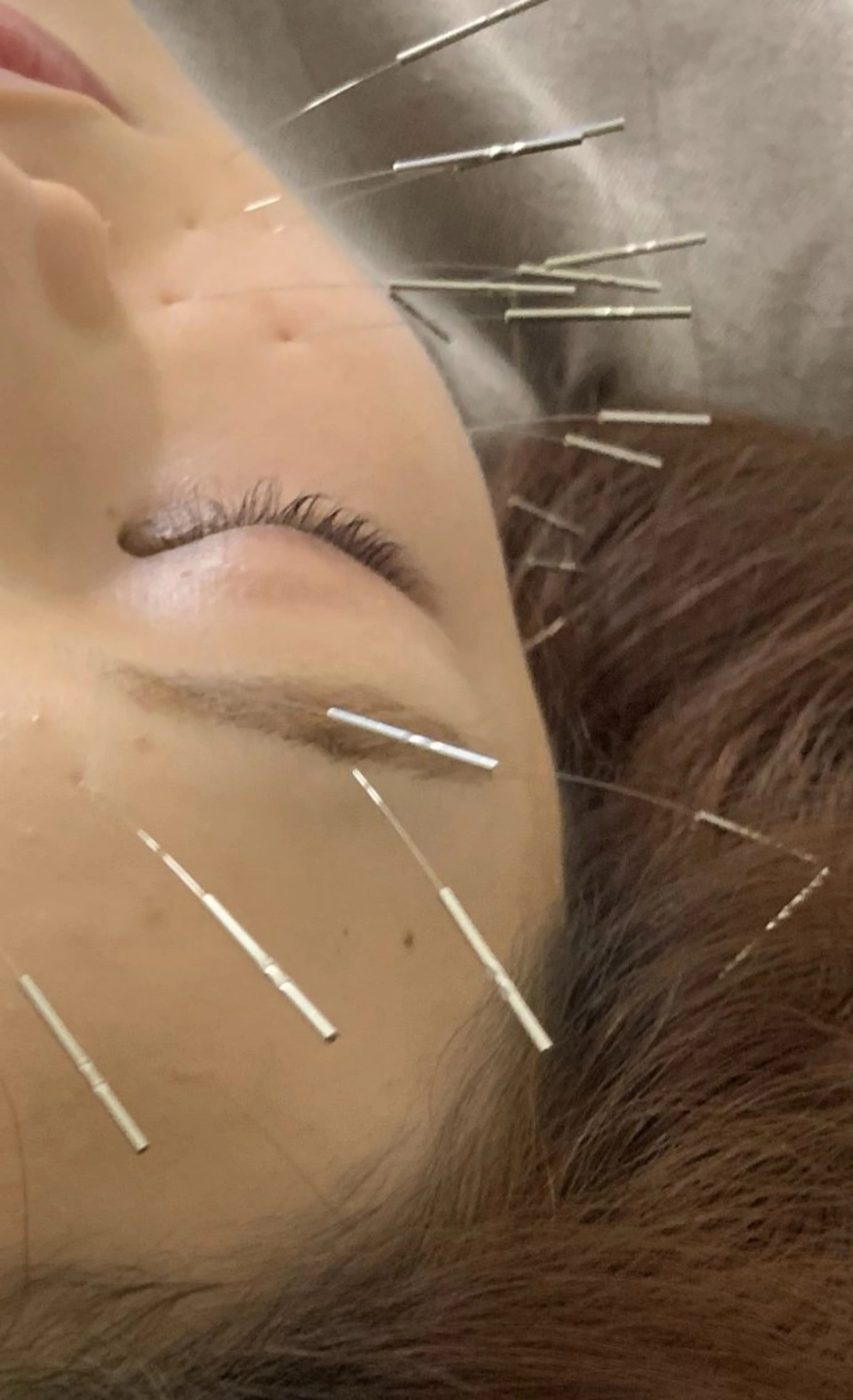 表参道鍼灸院K 美容鍼🔮ララピールのエステ・リラクイメージ