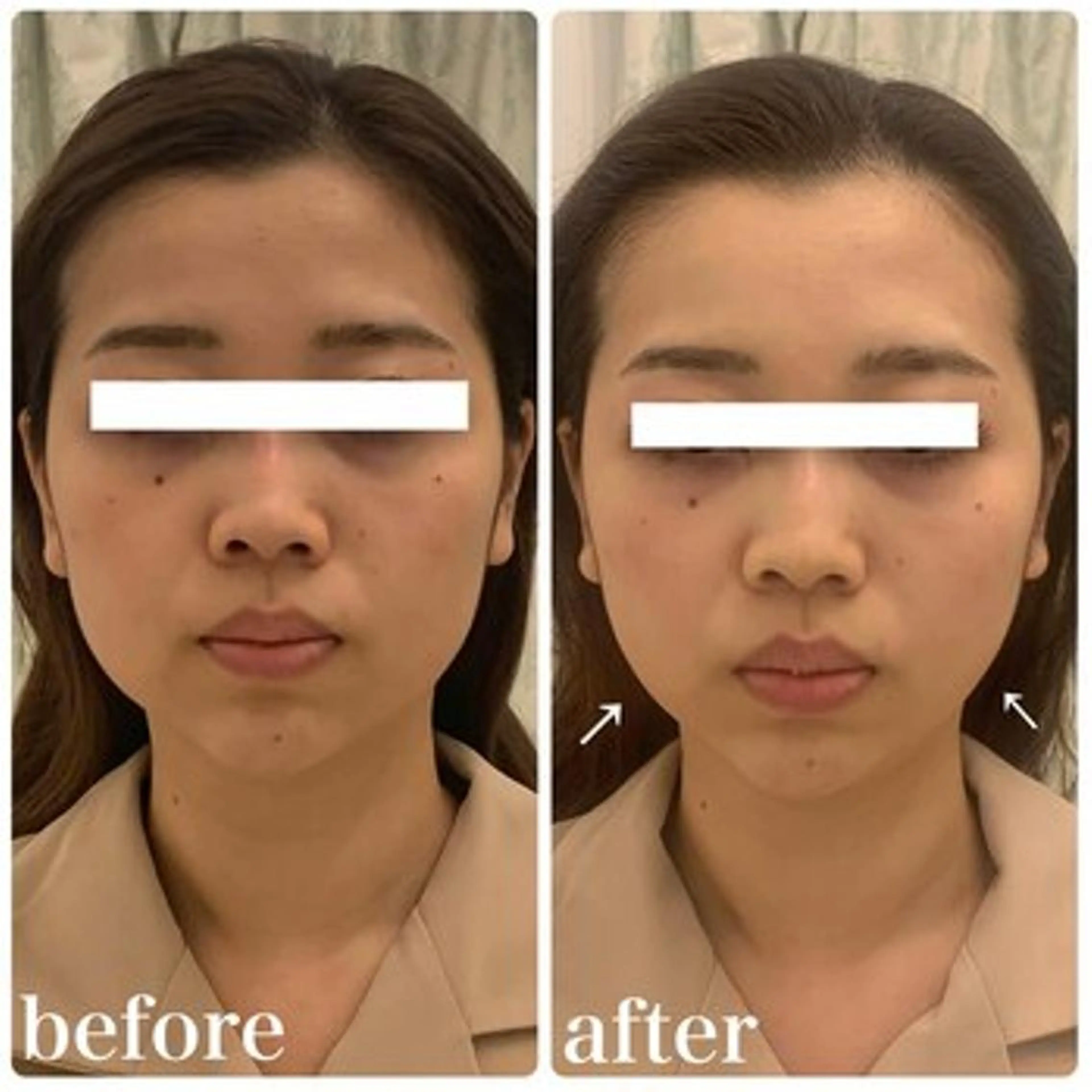 ニキビ/美肌 メゾンリュバンのエステ・リラクイメージ