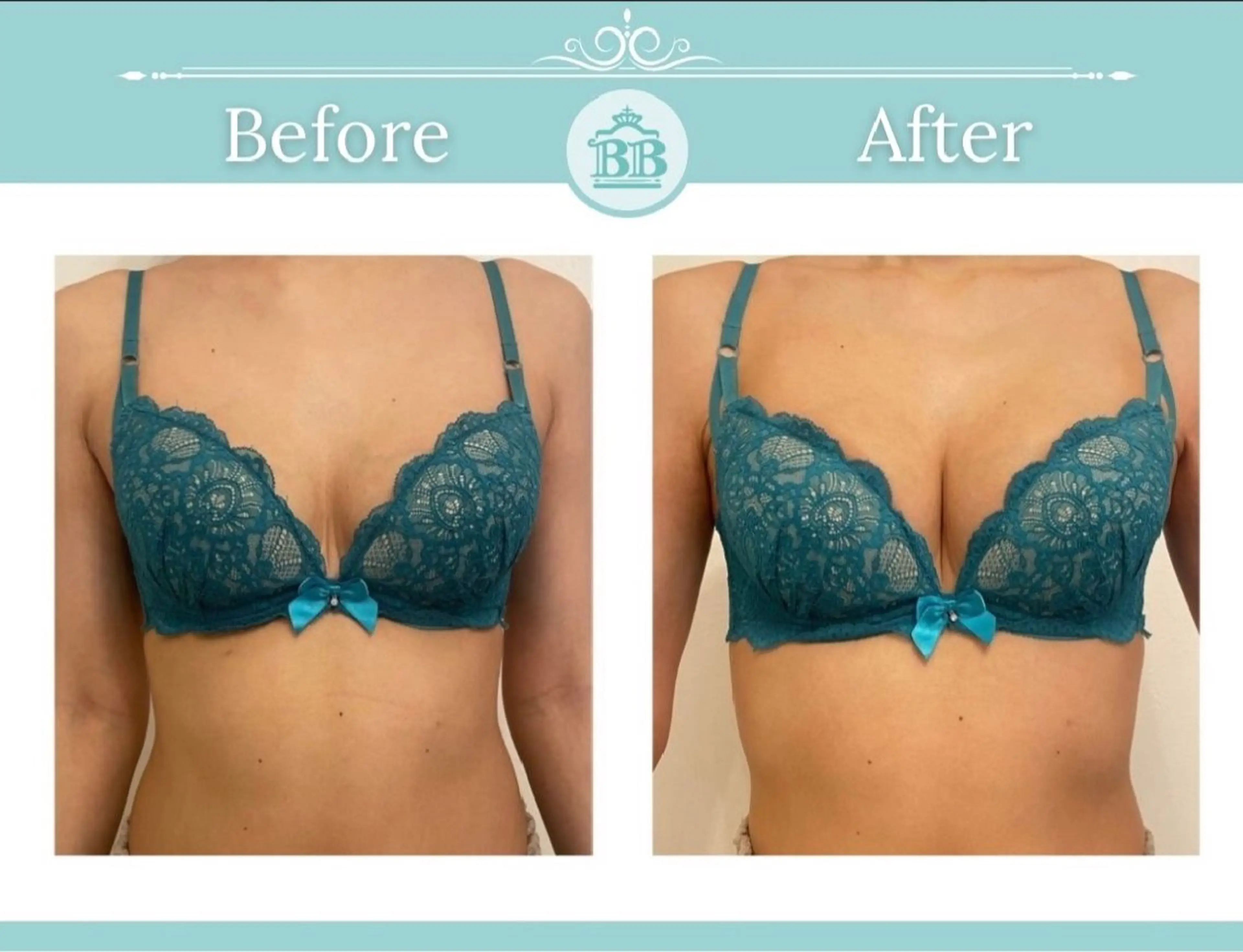 エステ 美人バスト本厚木店所属・美人バスト 本厚木店のエステ・リラクイメージ