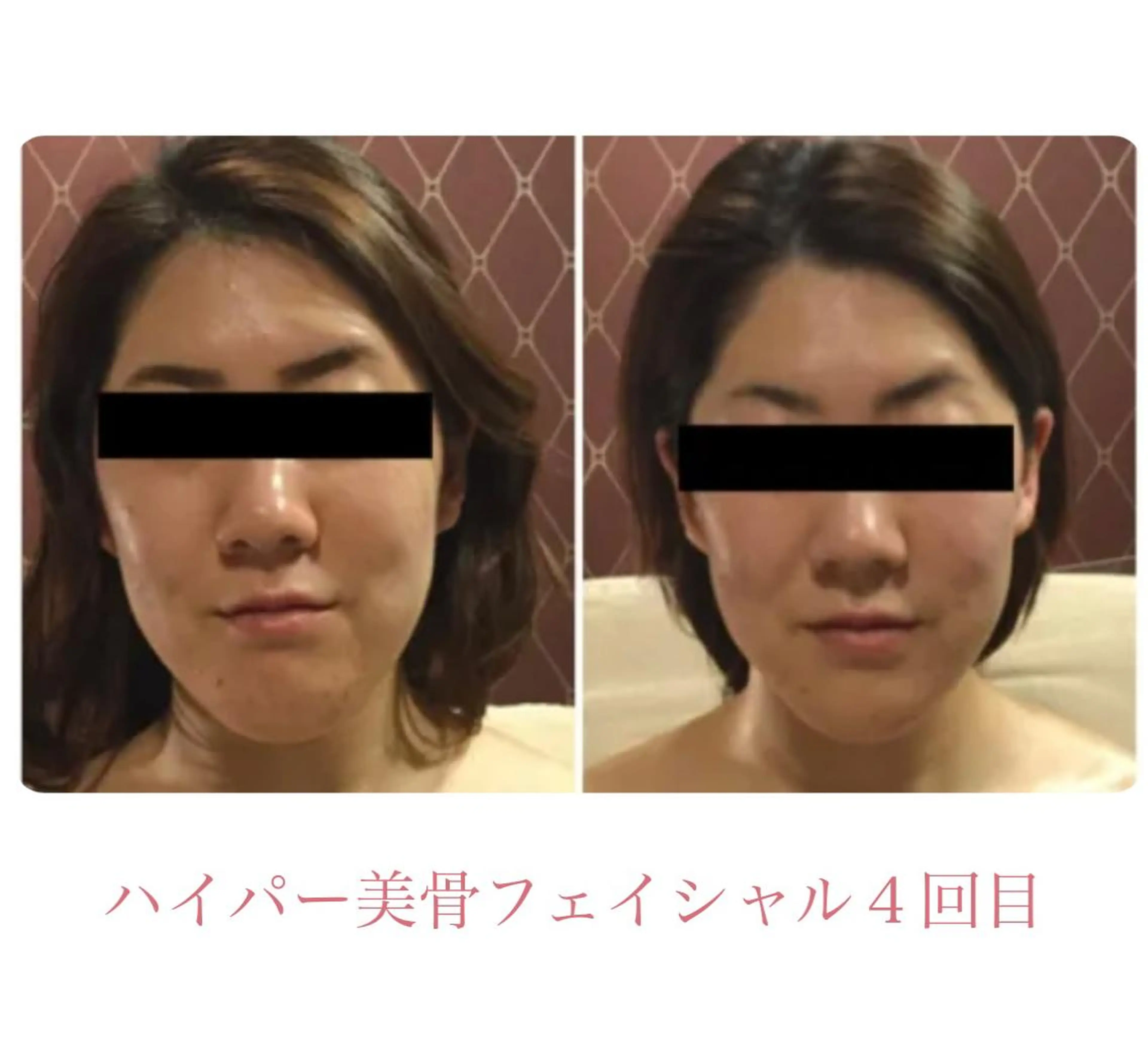 DEA  LUCE所属・痩身&小顔エステ DEA   LUCEのエステ・リラクイメージ