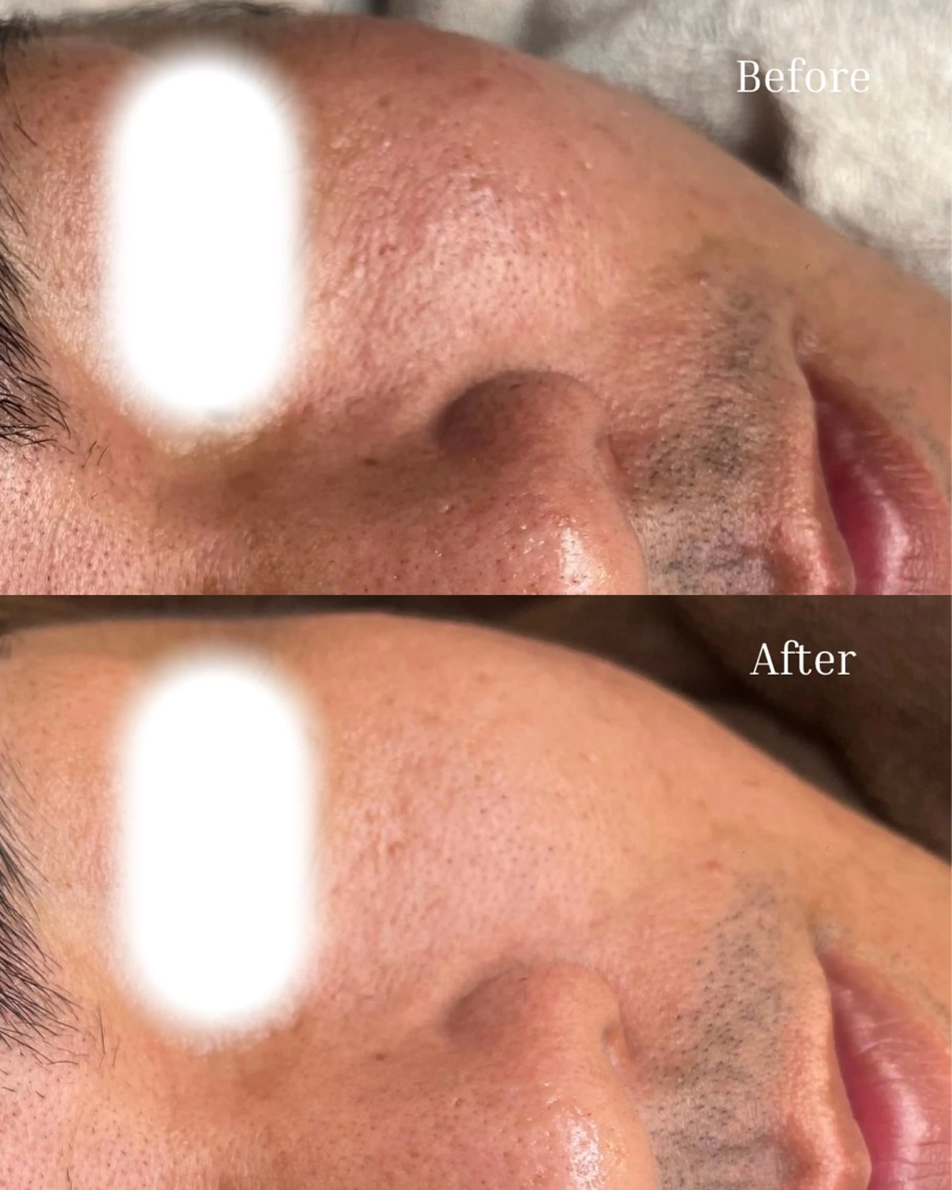 エステ BELLIS HUIT所属・ハーブピーリング那覇 BELLISHUITのエステ・リラクイメージ