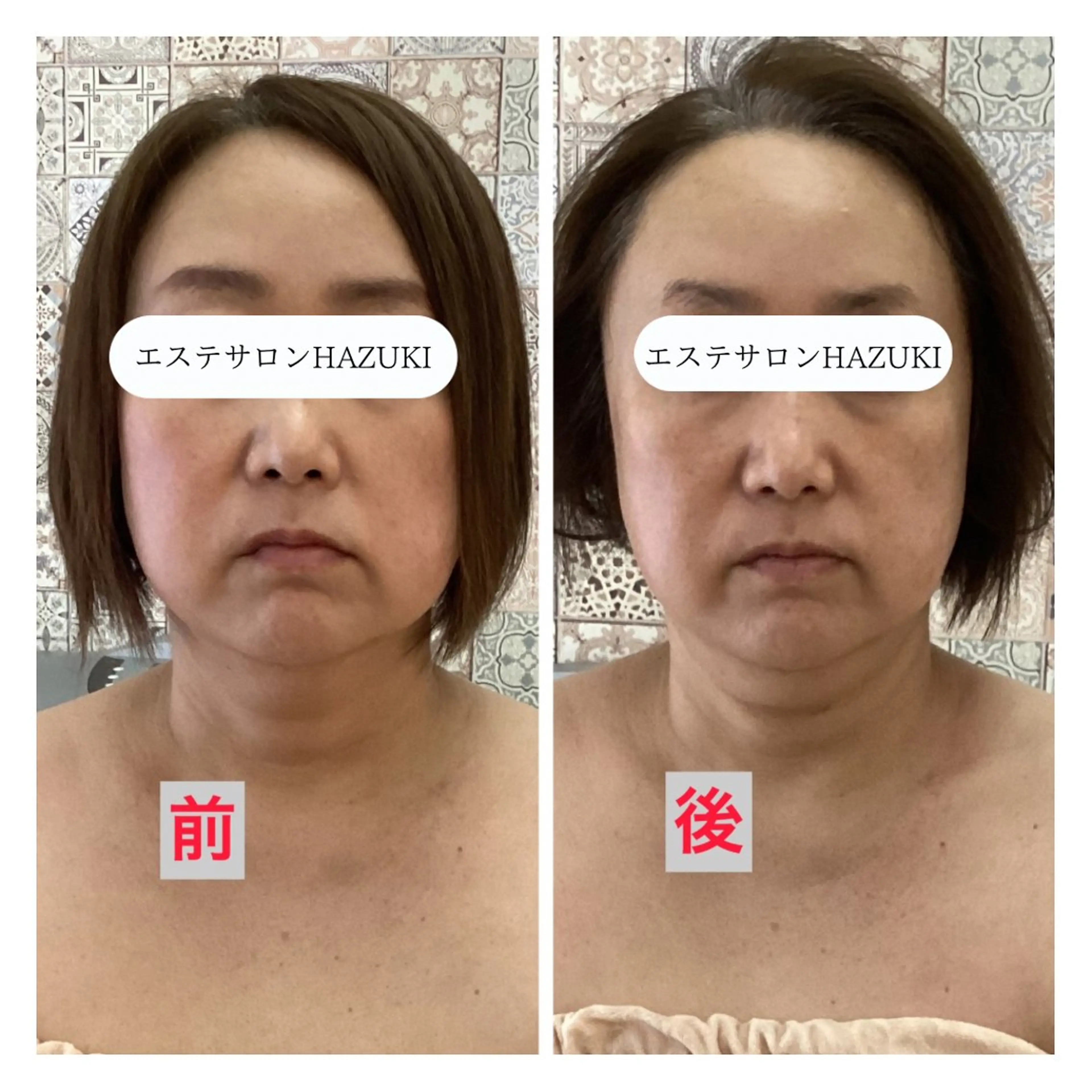 その他 たるみ改善小顔エステ 堀葉月のその他イメージ