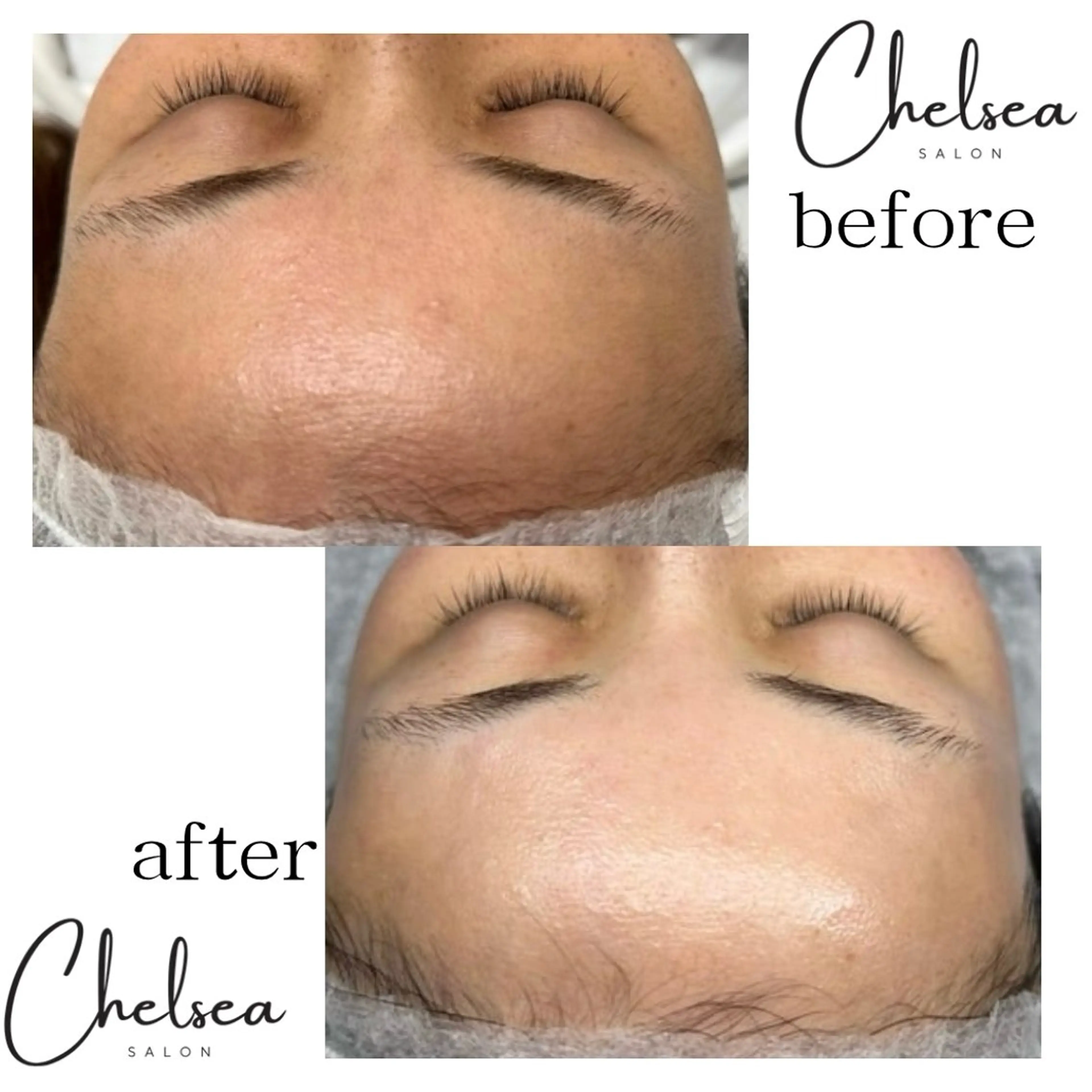 Chelsea所属・Chelsea 政　千尋のエステ・リラクイメージ