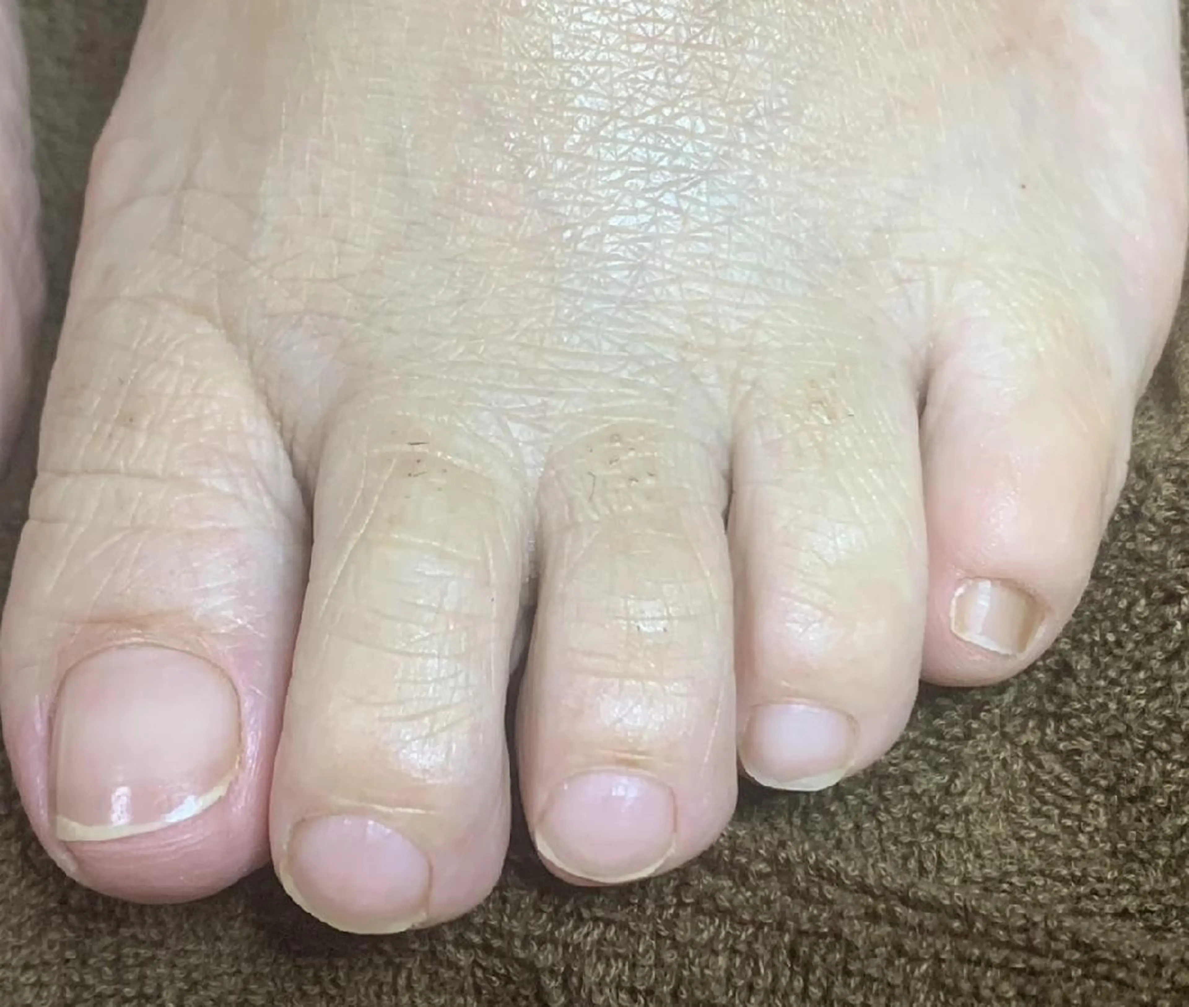 ネイル carenail　 tsugumiのその他イメージ