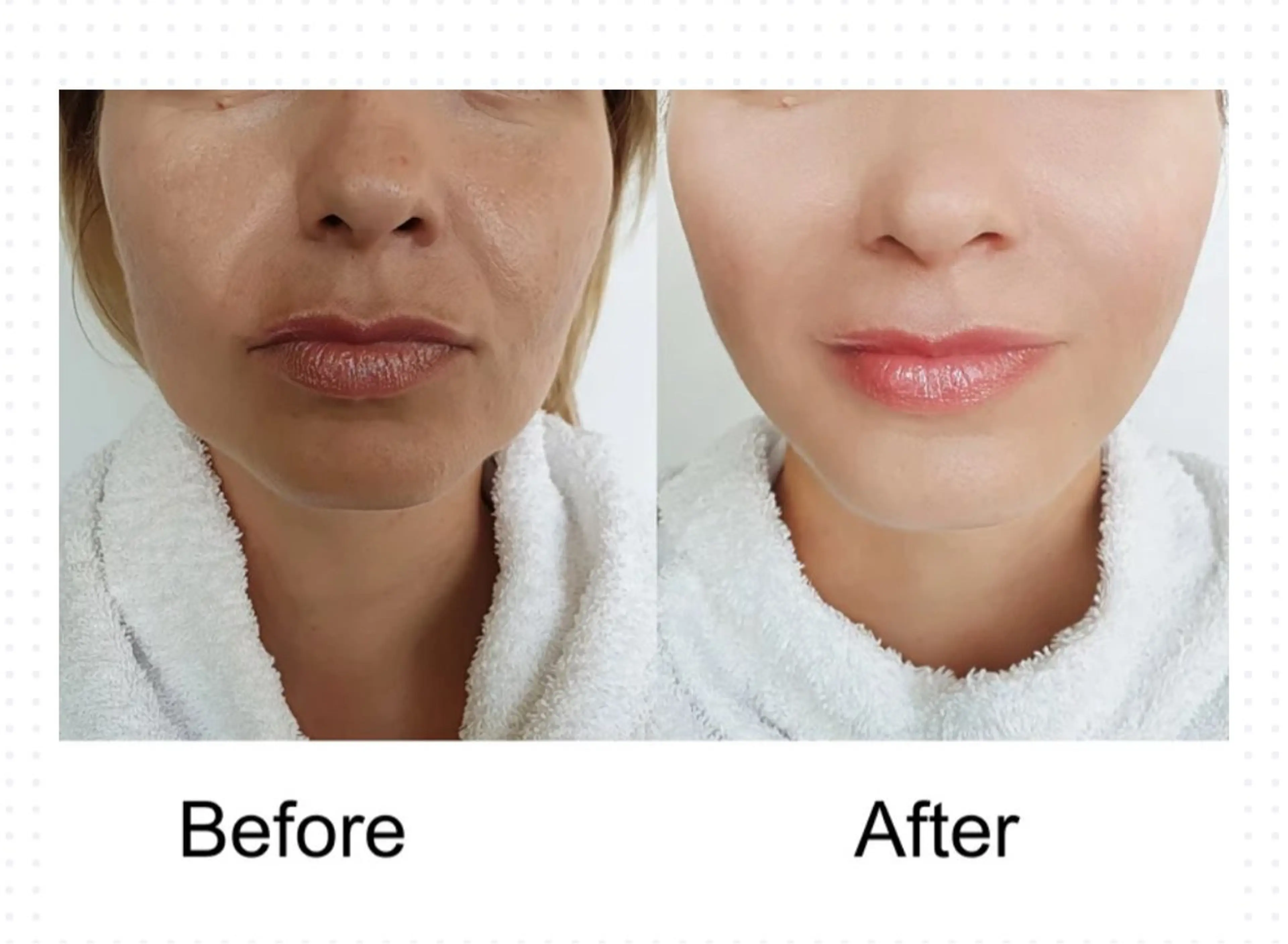 12月末までキャンペーン✨あと1名様限定‼️ 頭蓋骨矯正➕美容整体　【顔の歪み、頭の形、歯ぎしり、眼精疲労、痩身など】の写真