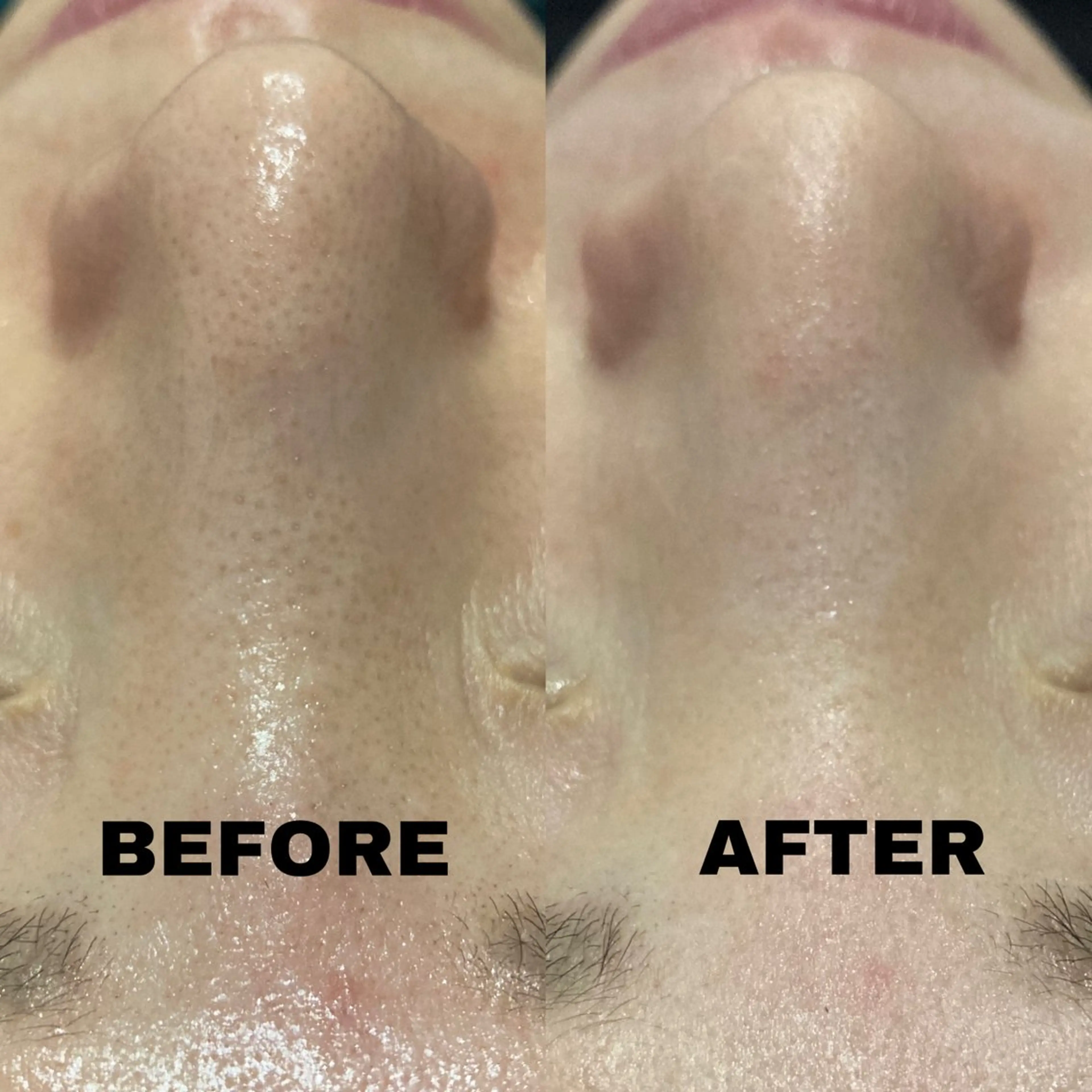 エステ NANI OAFU所属・NANIOAFU [なんば店］のその他イメージ