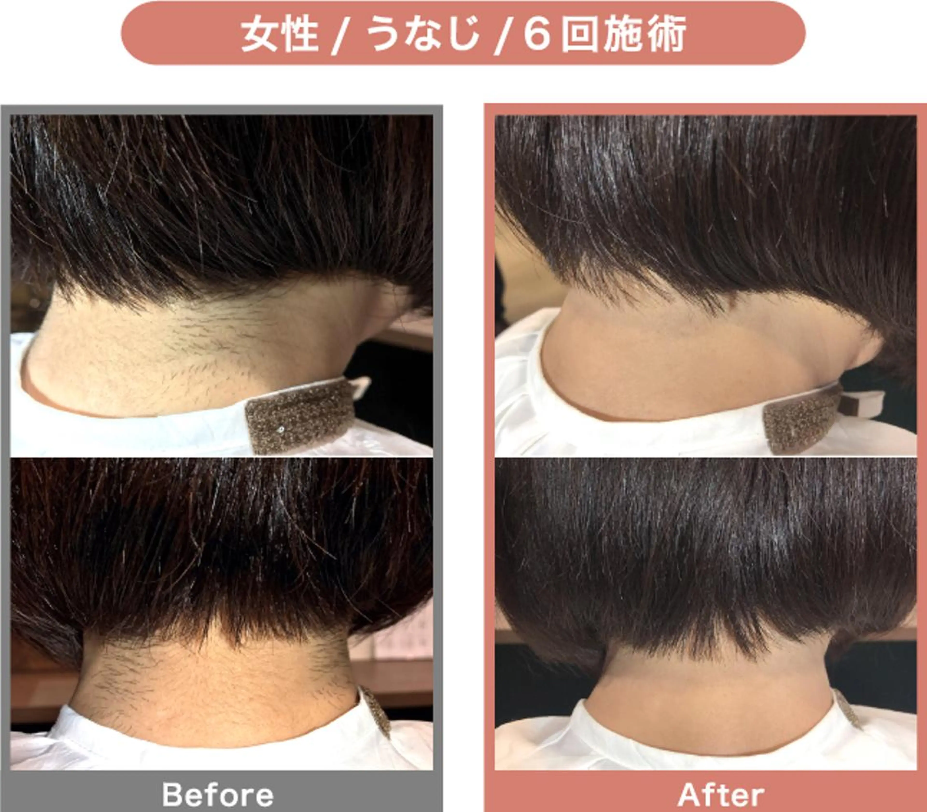 NONOKEKE ノノケケのエステ・リラクイメージ