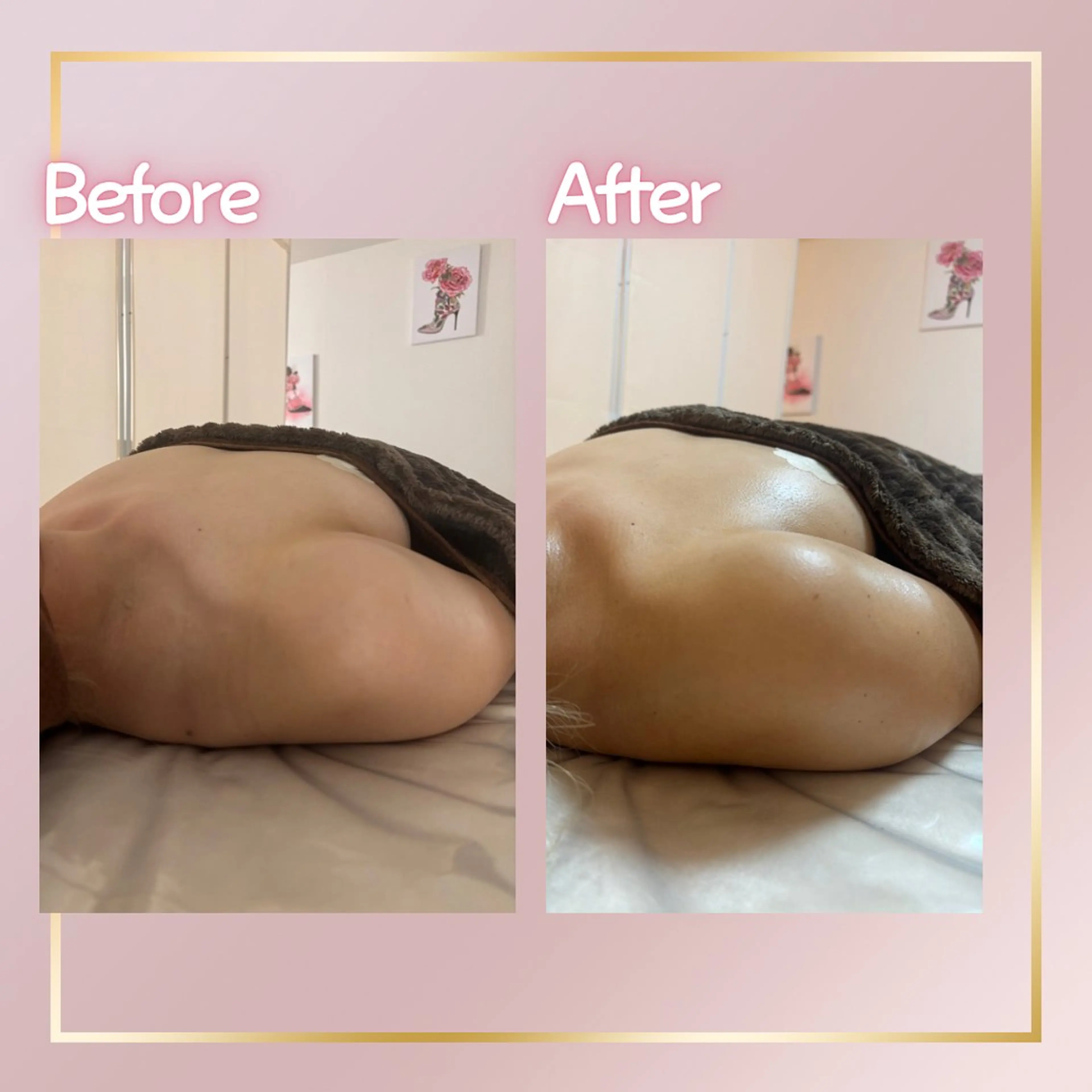 エステ ROSALIA 【バストアップ、痩身、毛穴洗浄】所属・ROSALIA バスト 小顔 毛穴のエステ・リラクイメージ