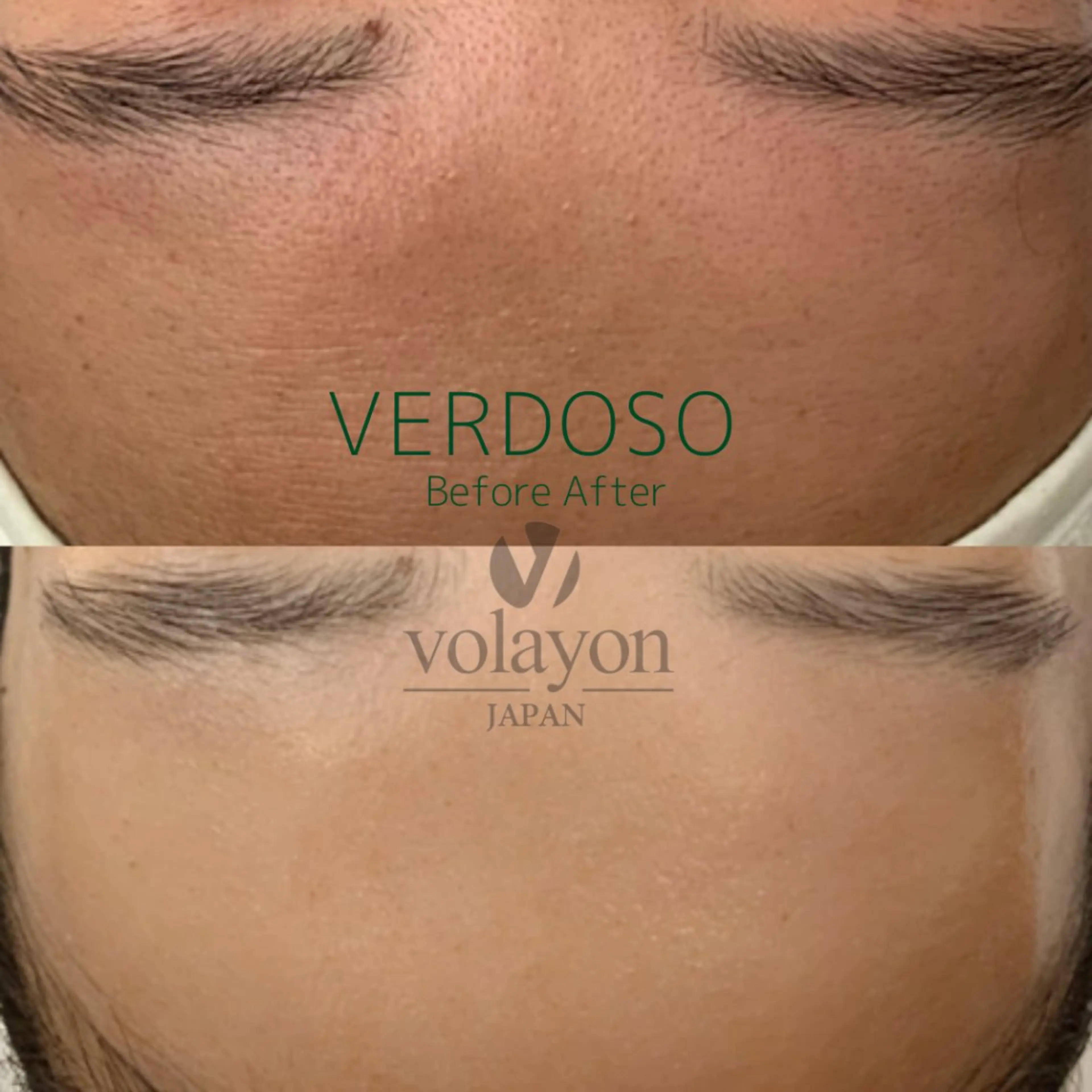 Hilluin所属・Hilluin 힐루인 韓国肌管理のエステ・リラクイメージ