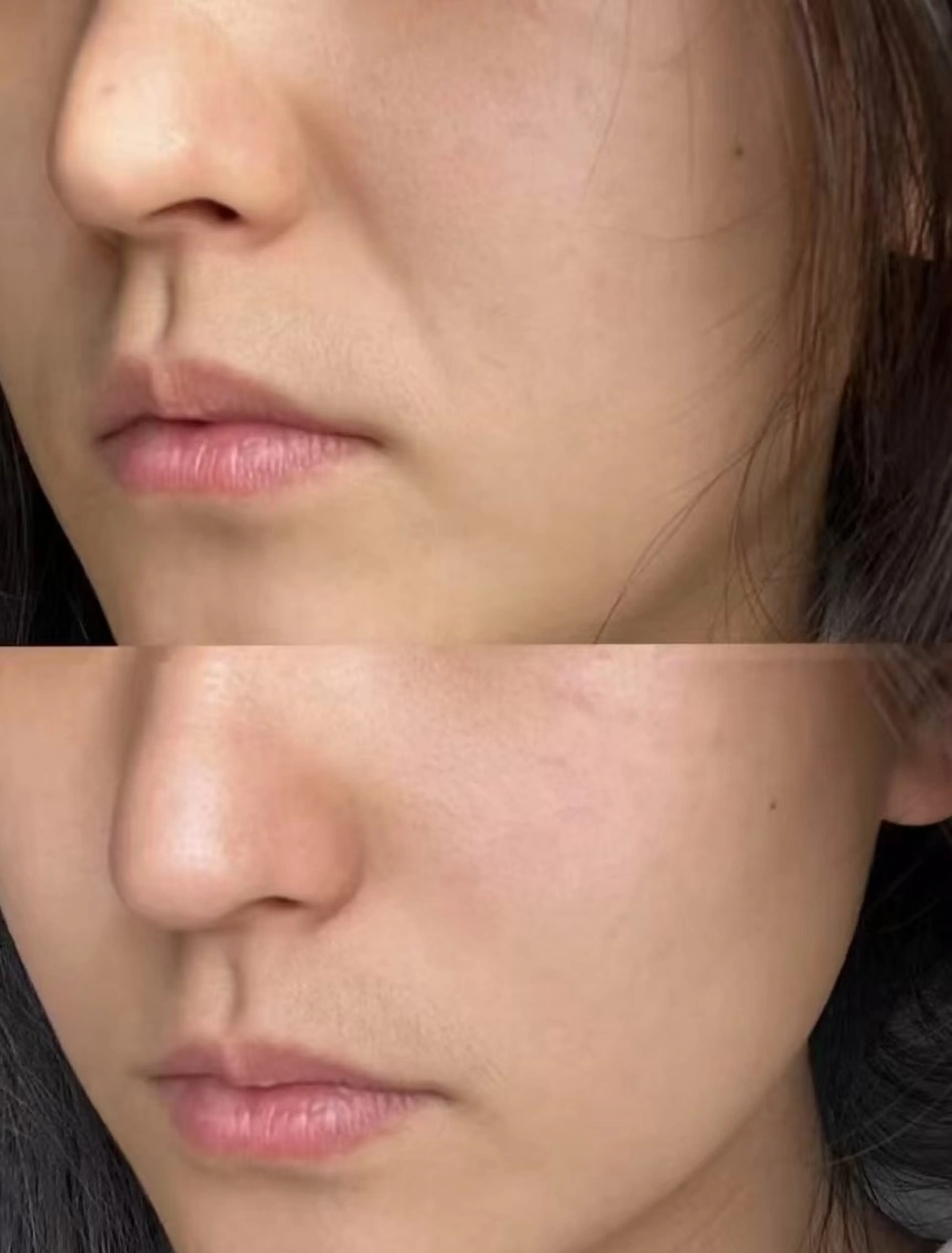 エステ aliaハイフ&水光ジェットサロン所属・aliaハーブ水光店 エステティシャン募集のエステ・リラクイメージ