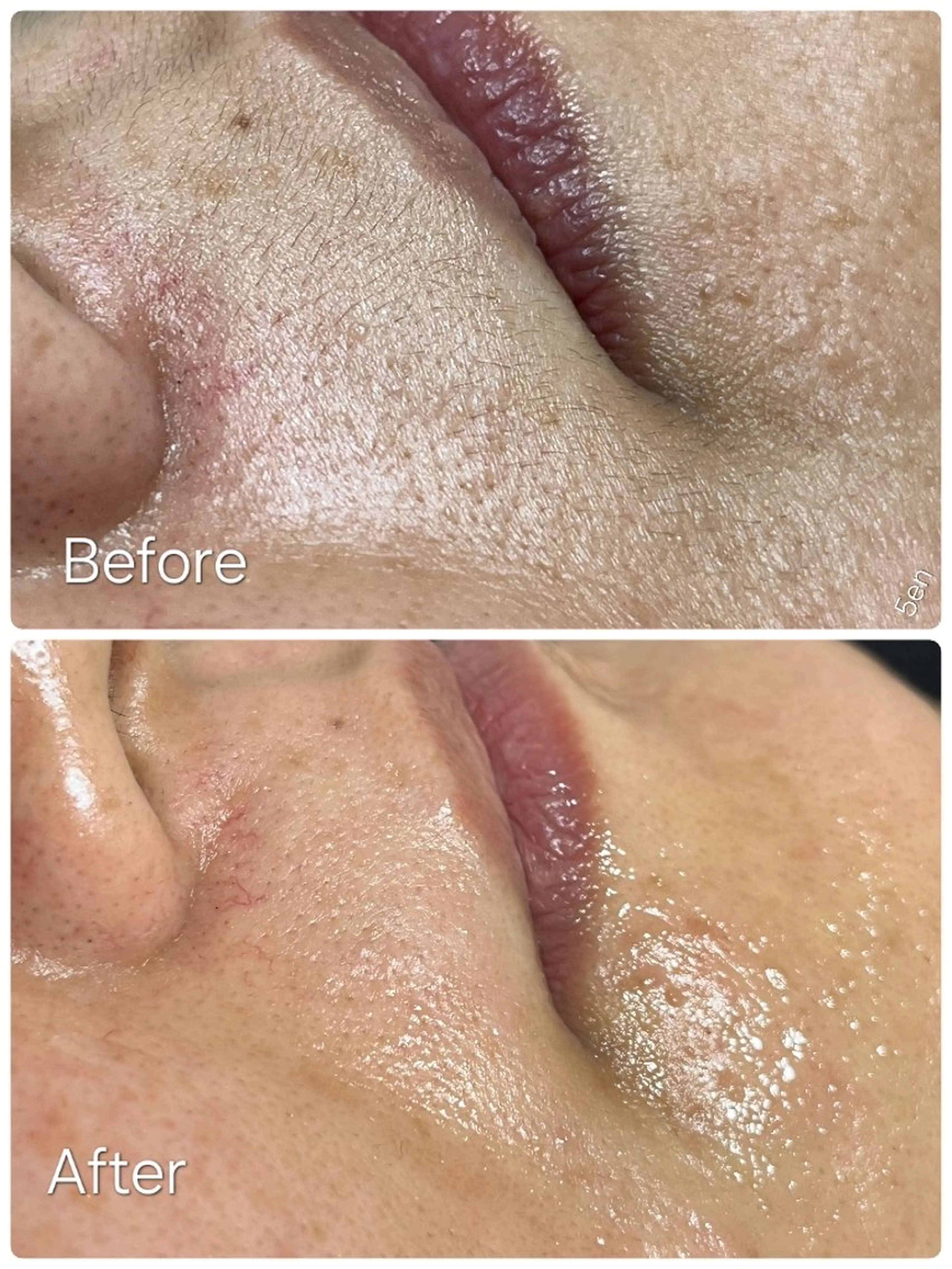 脱毛 シュガーリング/脱毛 EARLS三軒茶屋のエステ・リラクイメージ