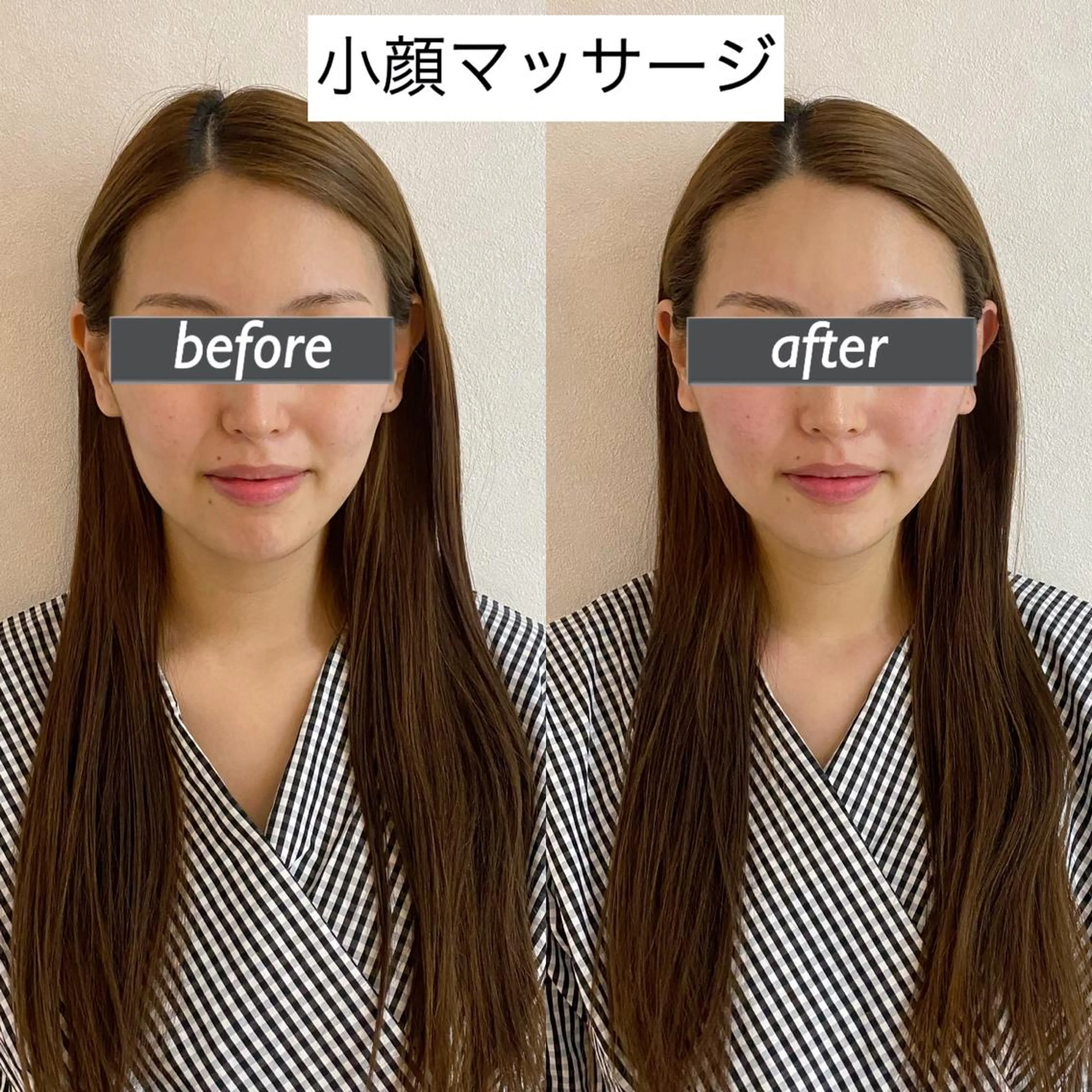 うなじ脱毛/美肌脱毛 LABELのエステ・リラクイメージ