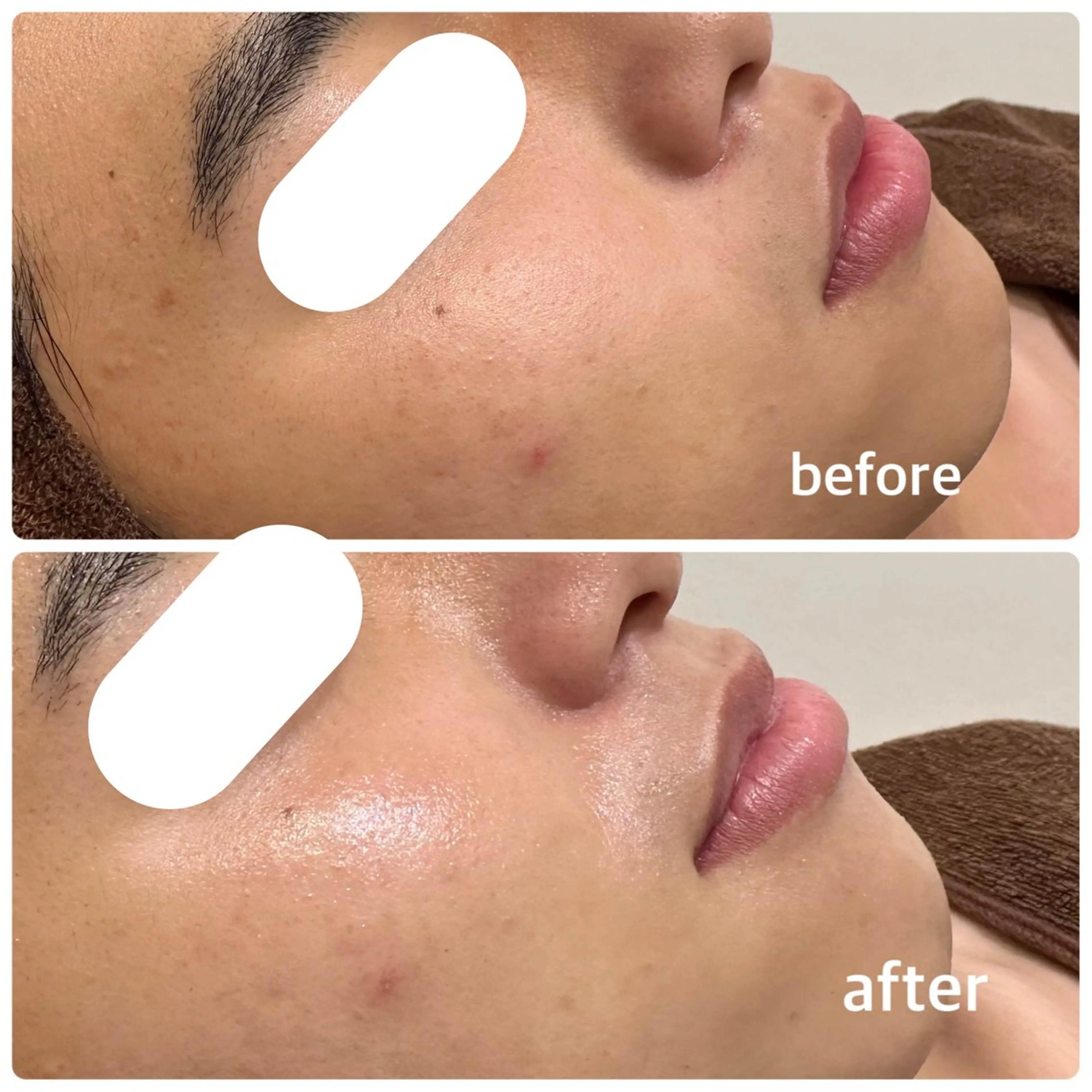 メンズ 今西 彩夢のエステ・リラクイメージ