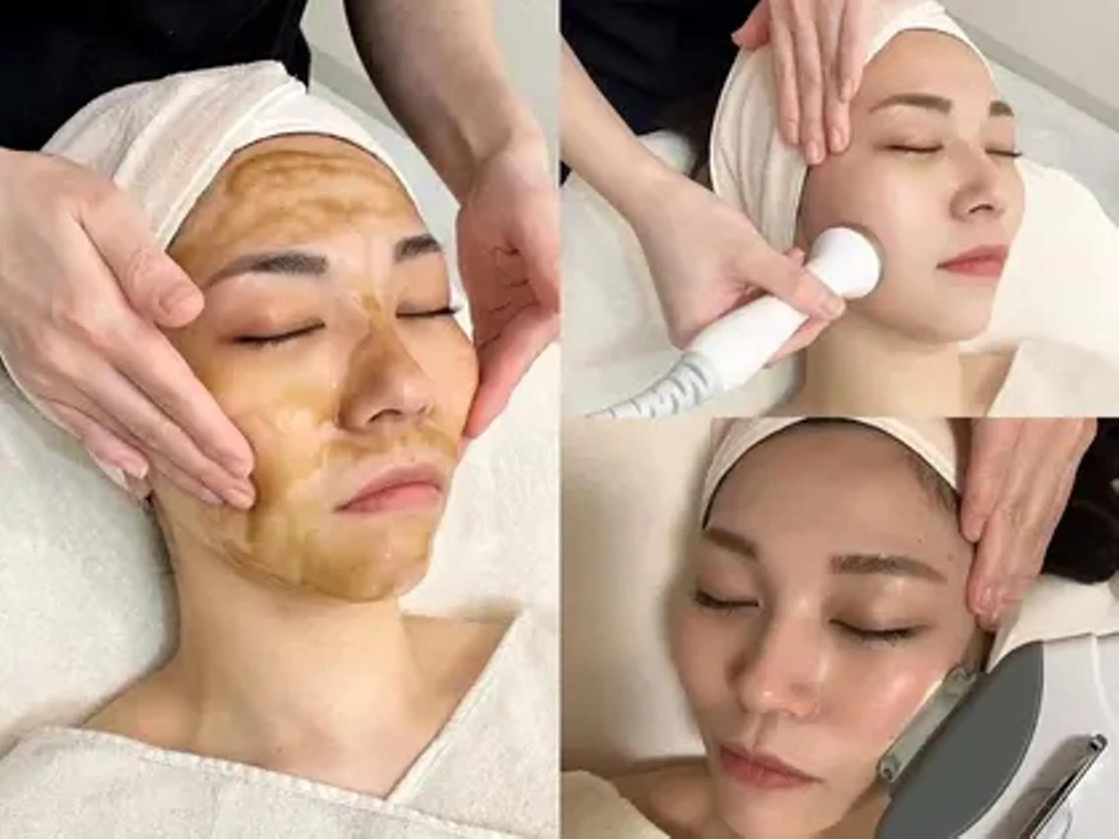 【ニキビレス肌へ最短アプローチ💛】ハーブピーリング🍀＋美肌フォト＋VCペプチド幹細胞✨の写真