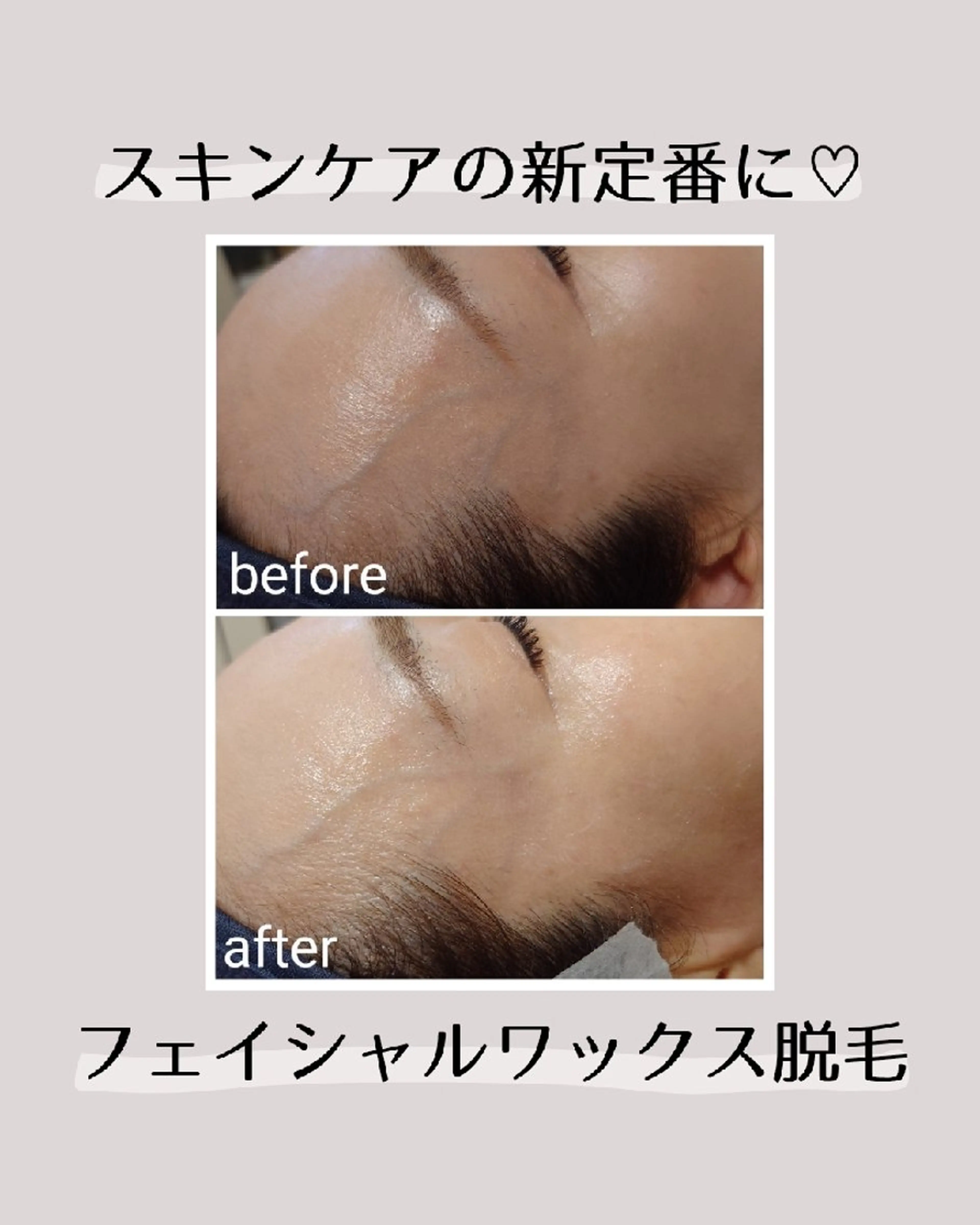 脱毛 濱田 優子のエステ・リラクイメージ