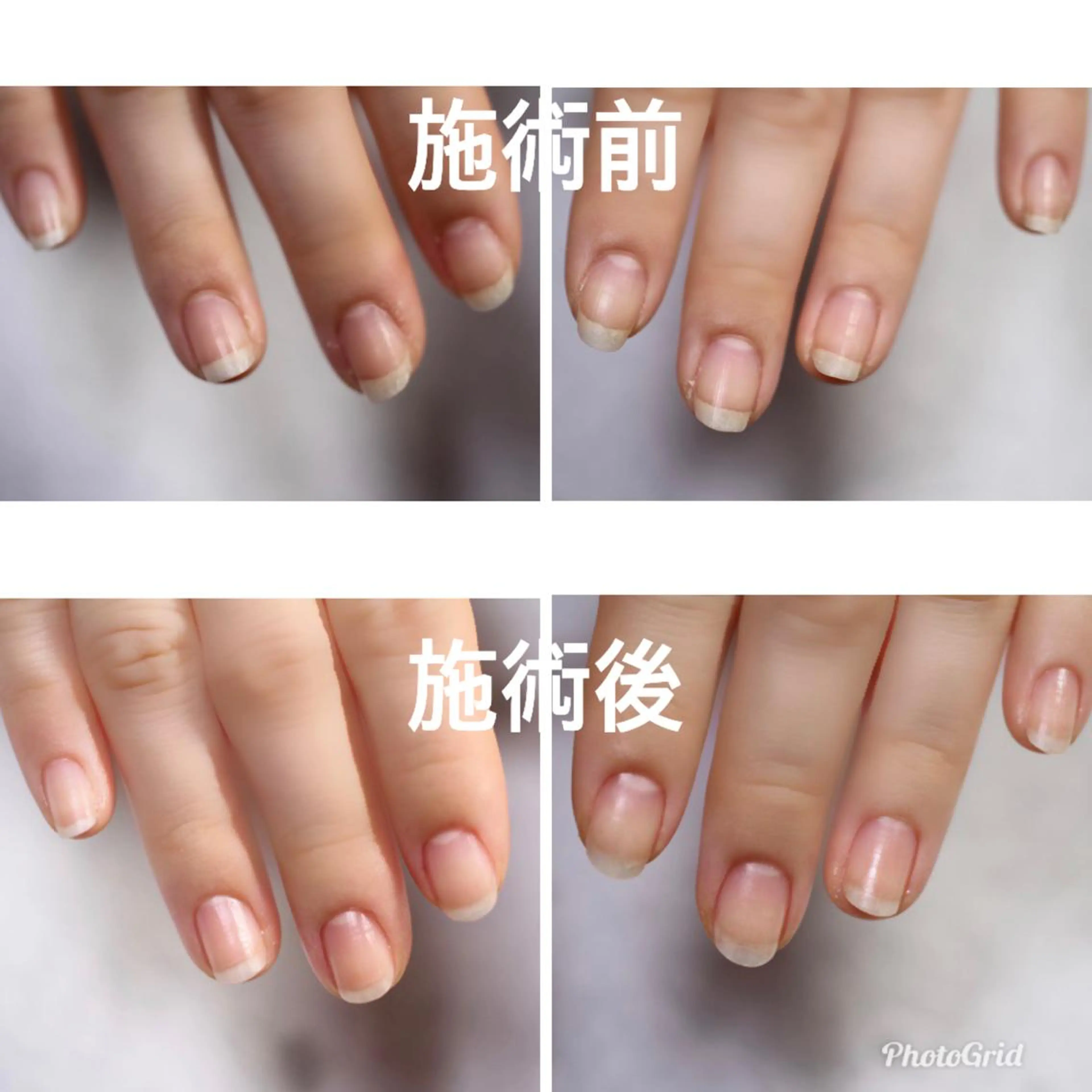 ネイル ママリンド　志村坂上店所属・しみ えんのネイルデザイン