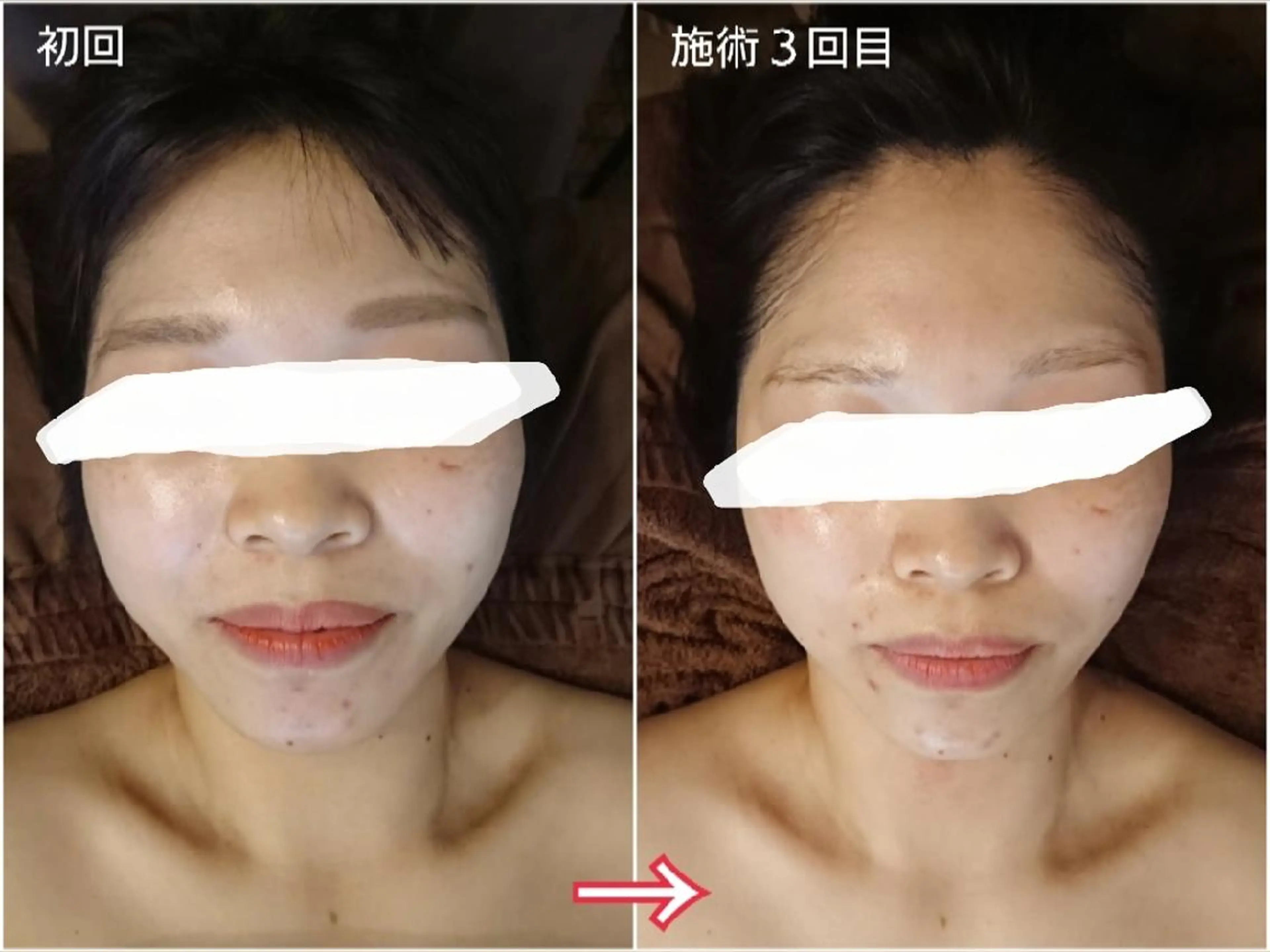 Jeliss~美爪育成ネイル＆頭蓋骨小顔矯正サロン~所属・美顔(小顔)矯正& 美爪育成Jelissのエステ・リラクイメージ