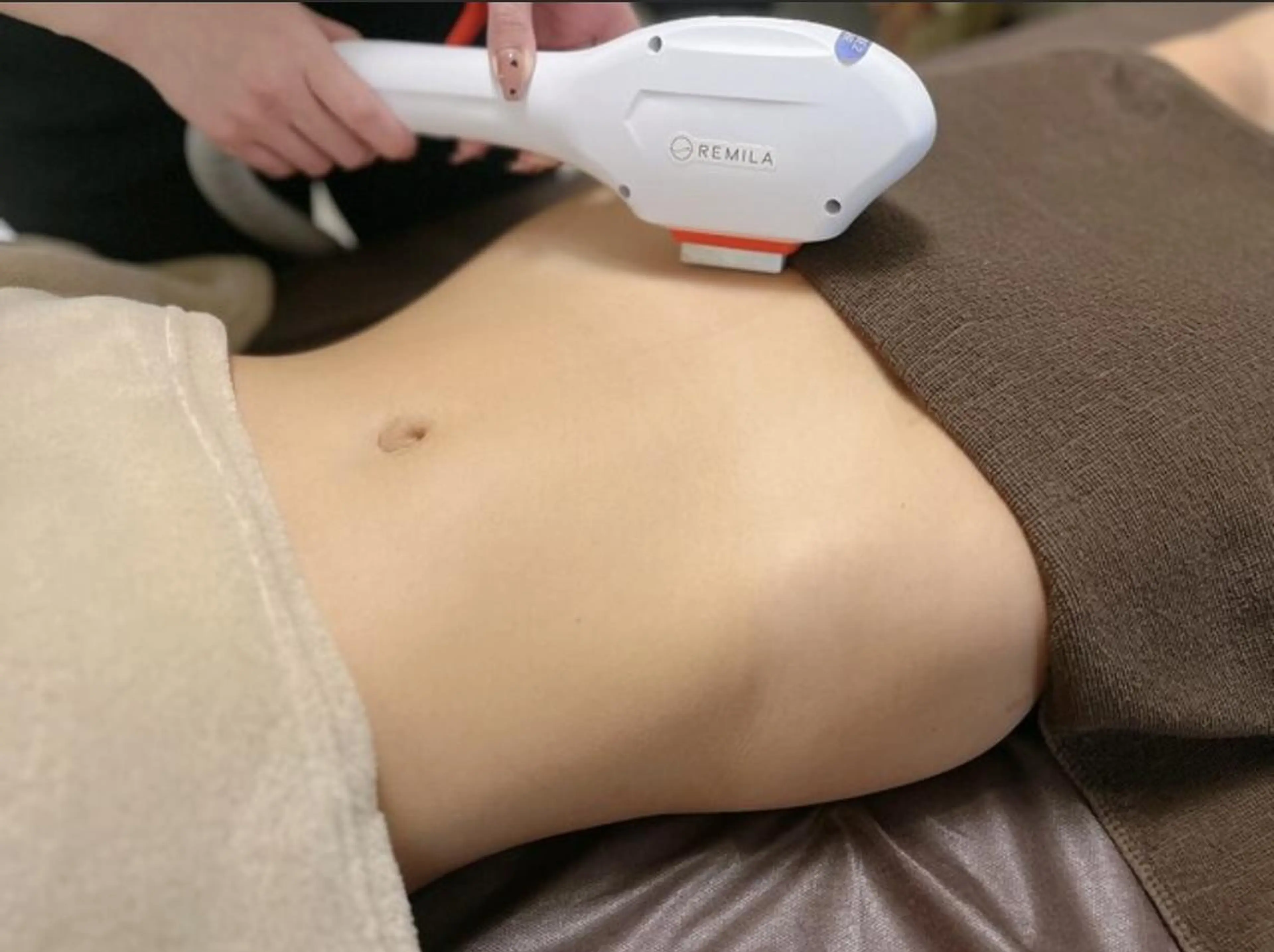 【VIO光脱毛】(黒ずみ改善)¥10000→¥4500の写真