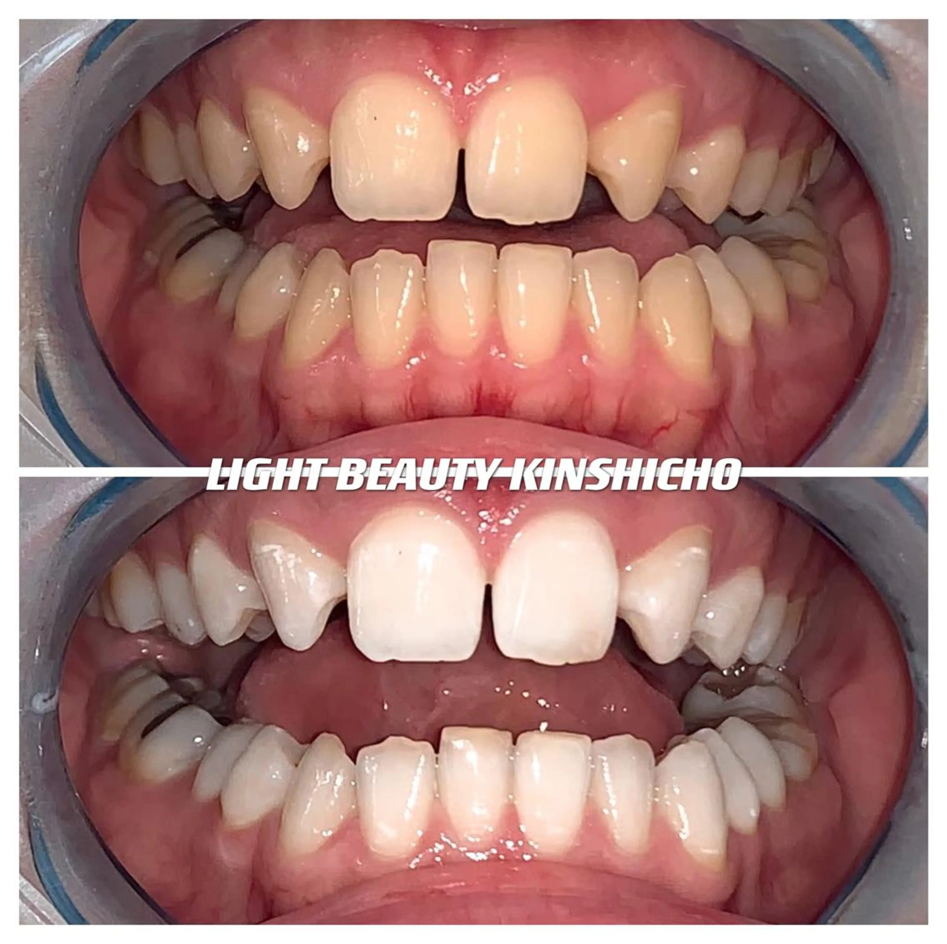 ライトビューティー 錦糸町店のエステ・リラクイメージ